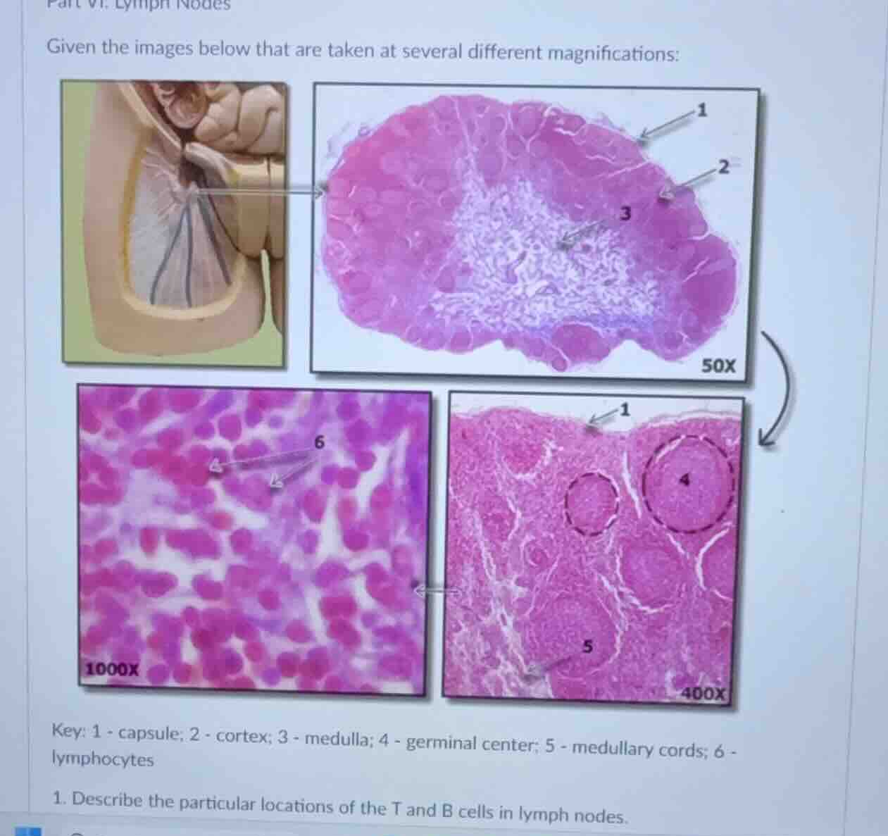 part vi. lymph nodes given the images below that are taken at several d…