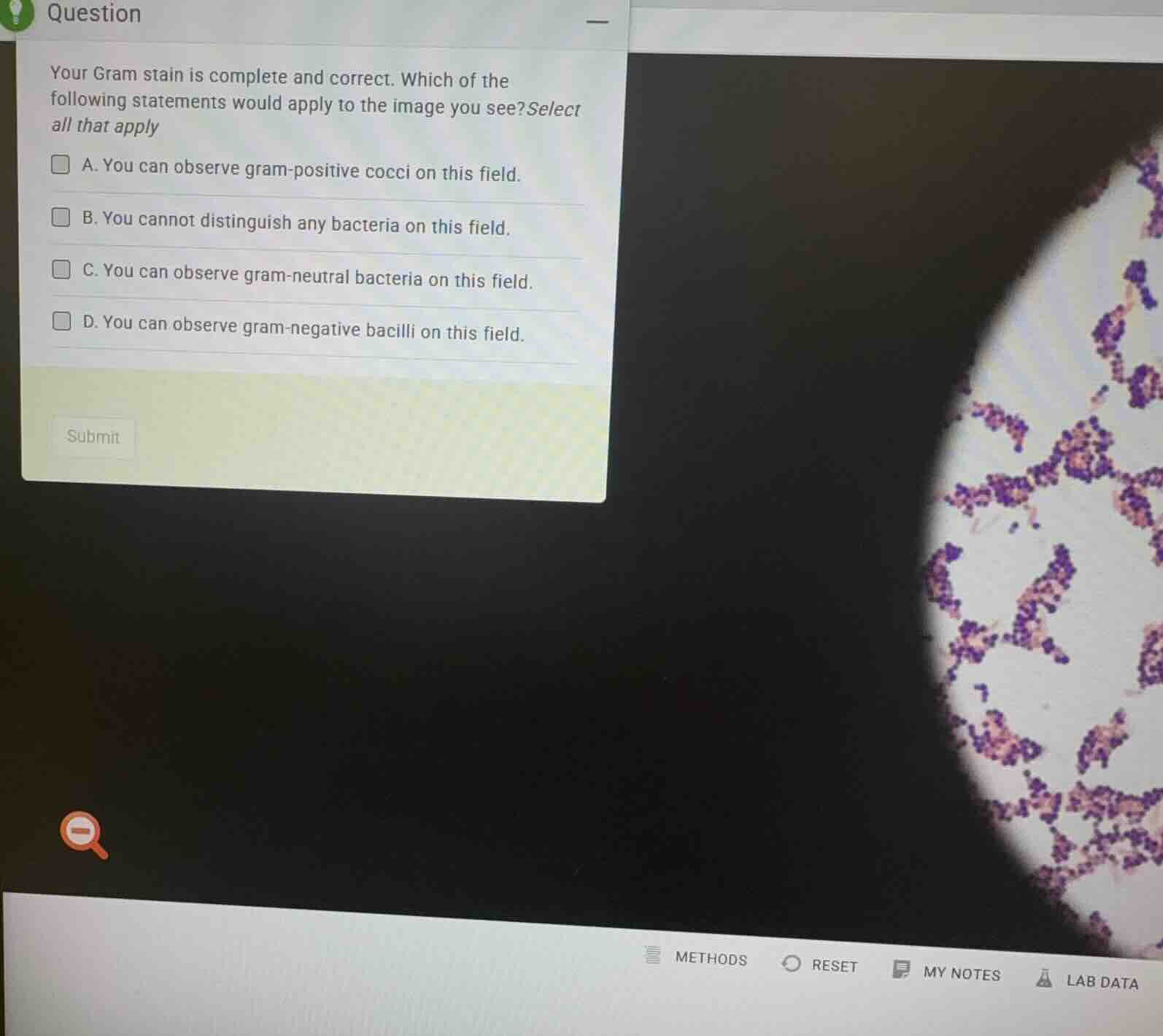 your gram stain is complete and correct. which of the following stateme…