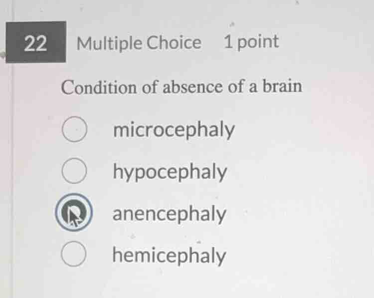 22 multiple choice 1 point condition of absence of a brain microcephaly…