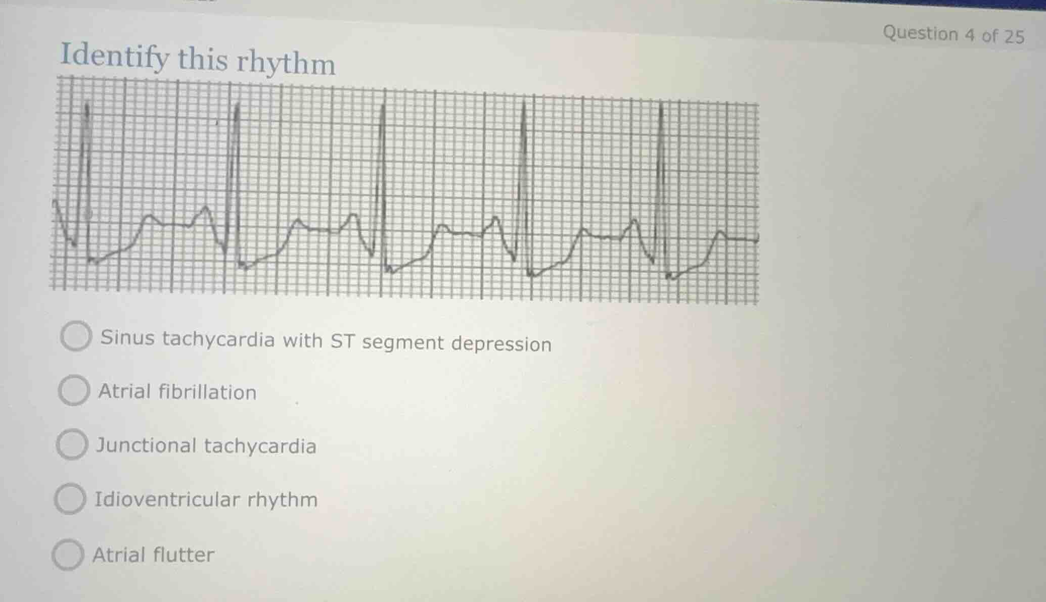identify this rhythm sinus tachycardia with st segment depression atria…