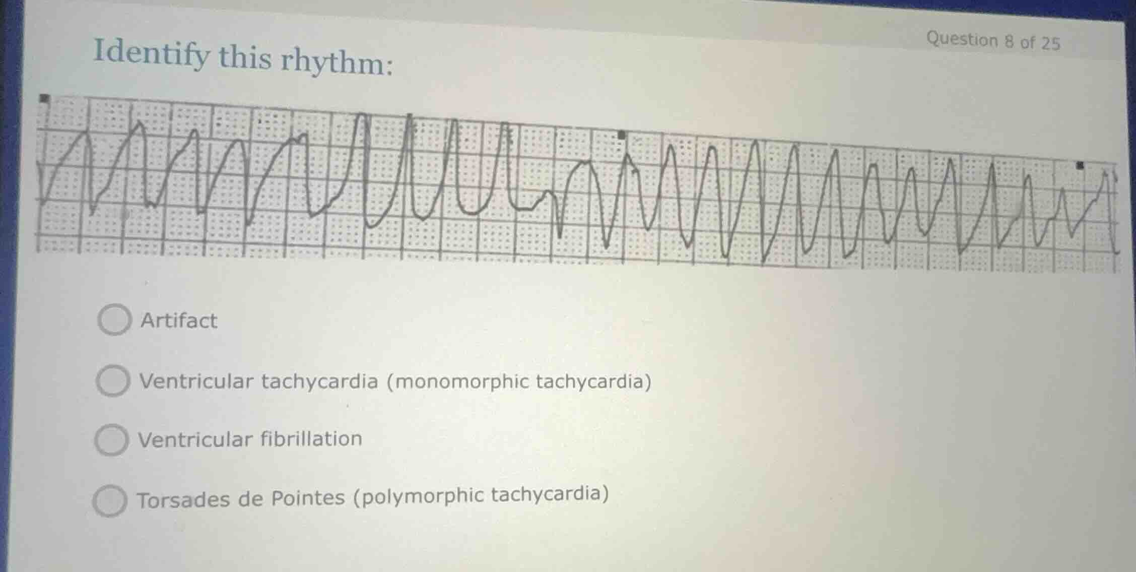 identify this rhythm: artifact ventricular tachycardia (monomorphic tac…