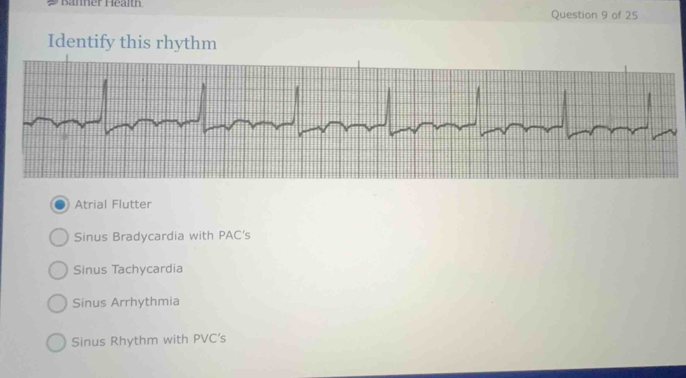 identify this rhythm atrial flutter sinus bradycardia with pacs sinus t…