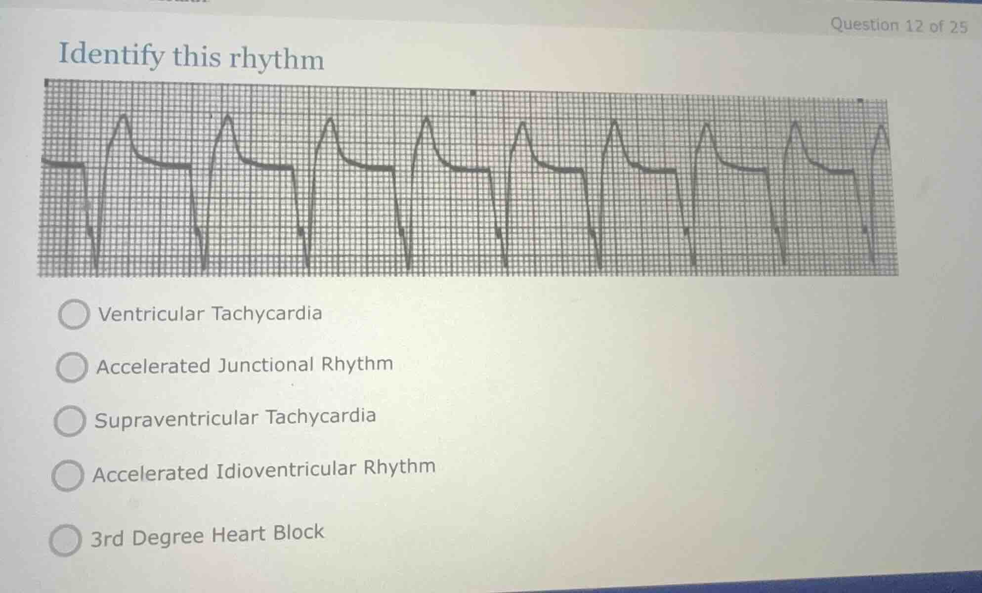 identify this rhythm - ventricular tachycardia - accelerated junctional…