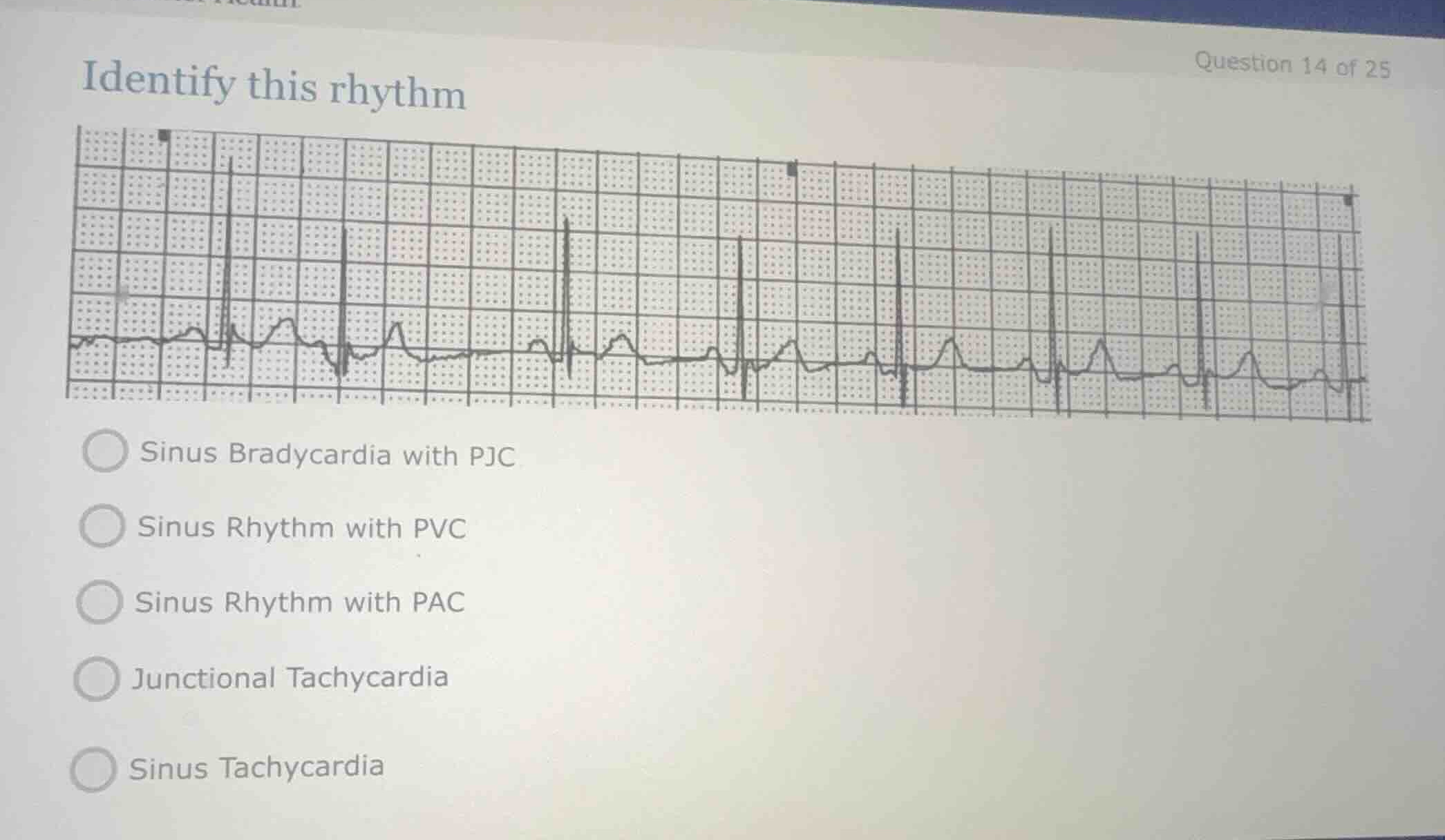 identify this rhythm sinus bradycardia with pjc sinus rhythm with pvc s…