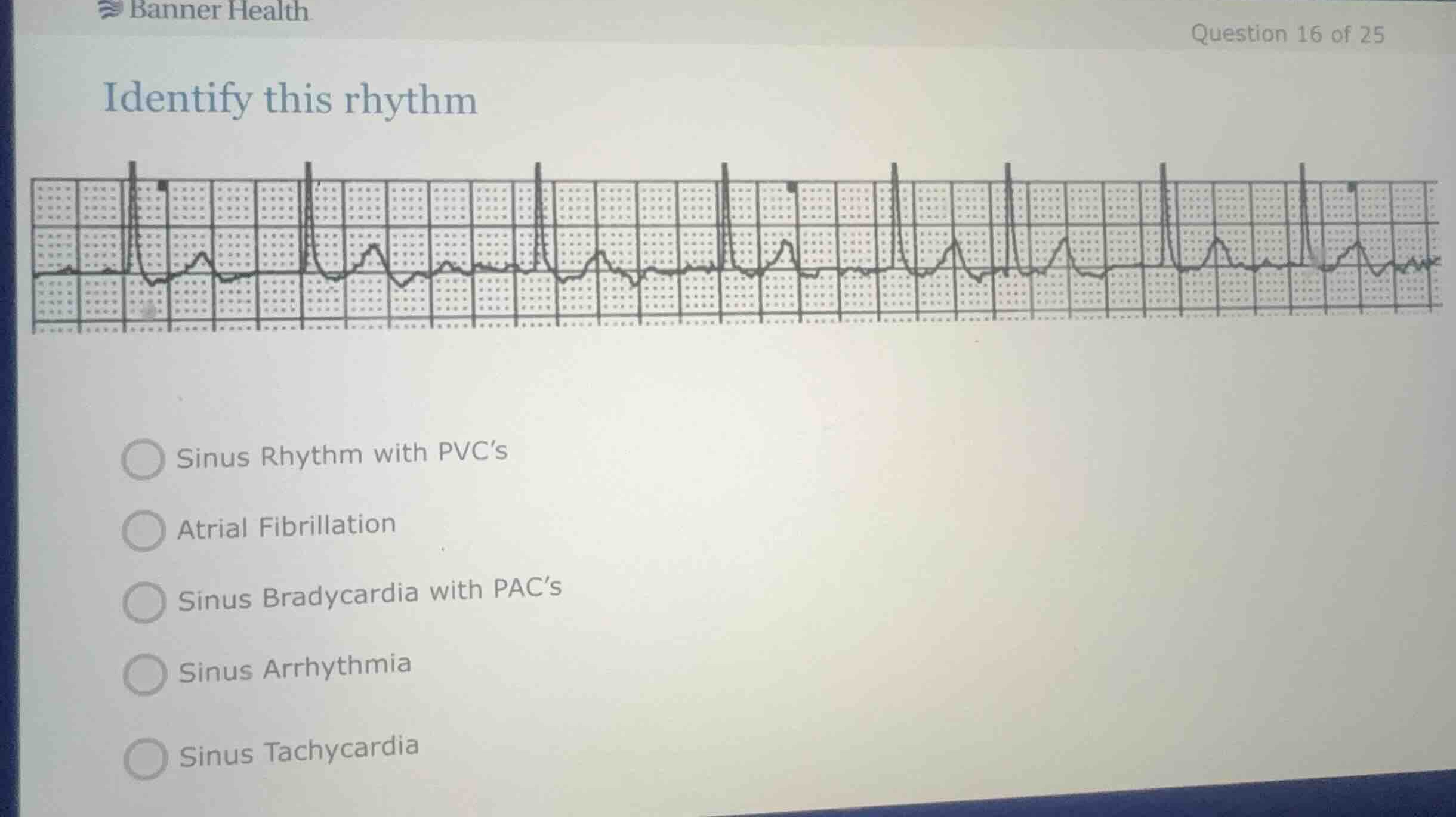 identify this rhythm - sinus rhythm with pvcs - atrial fibrillation - s…