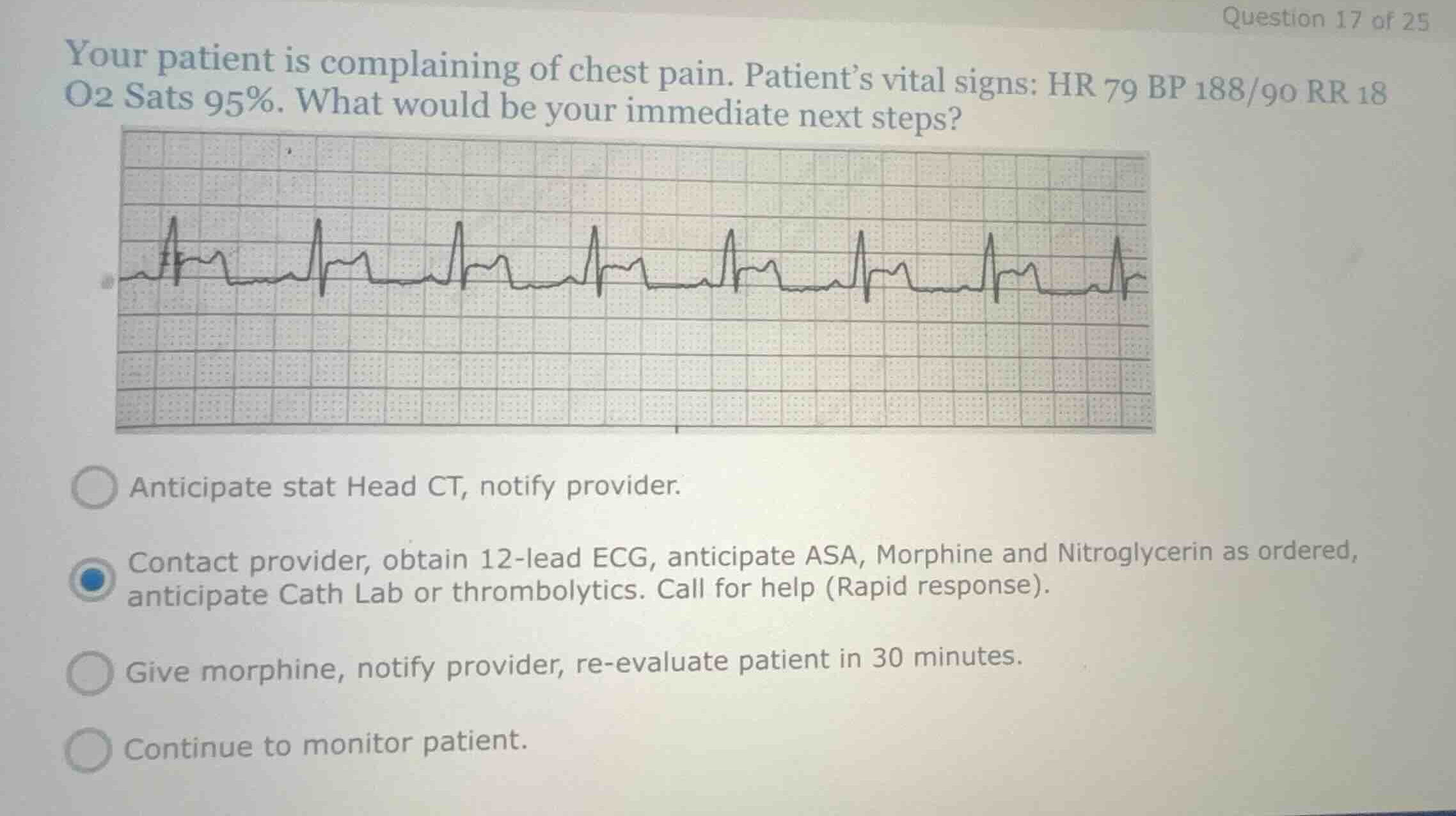 your patient is complaining of chest pain. patients vital signs: hr 79 …