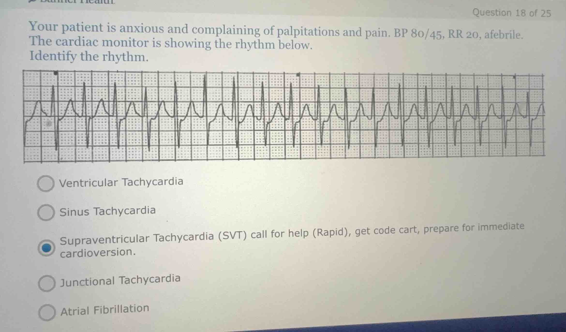 question 18 of 25 your patient is anxious and complaining of palpitatio…