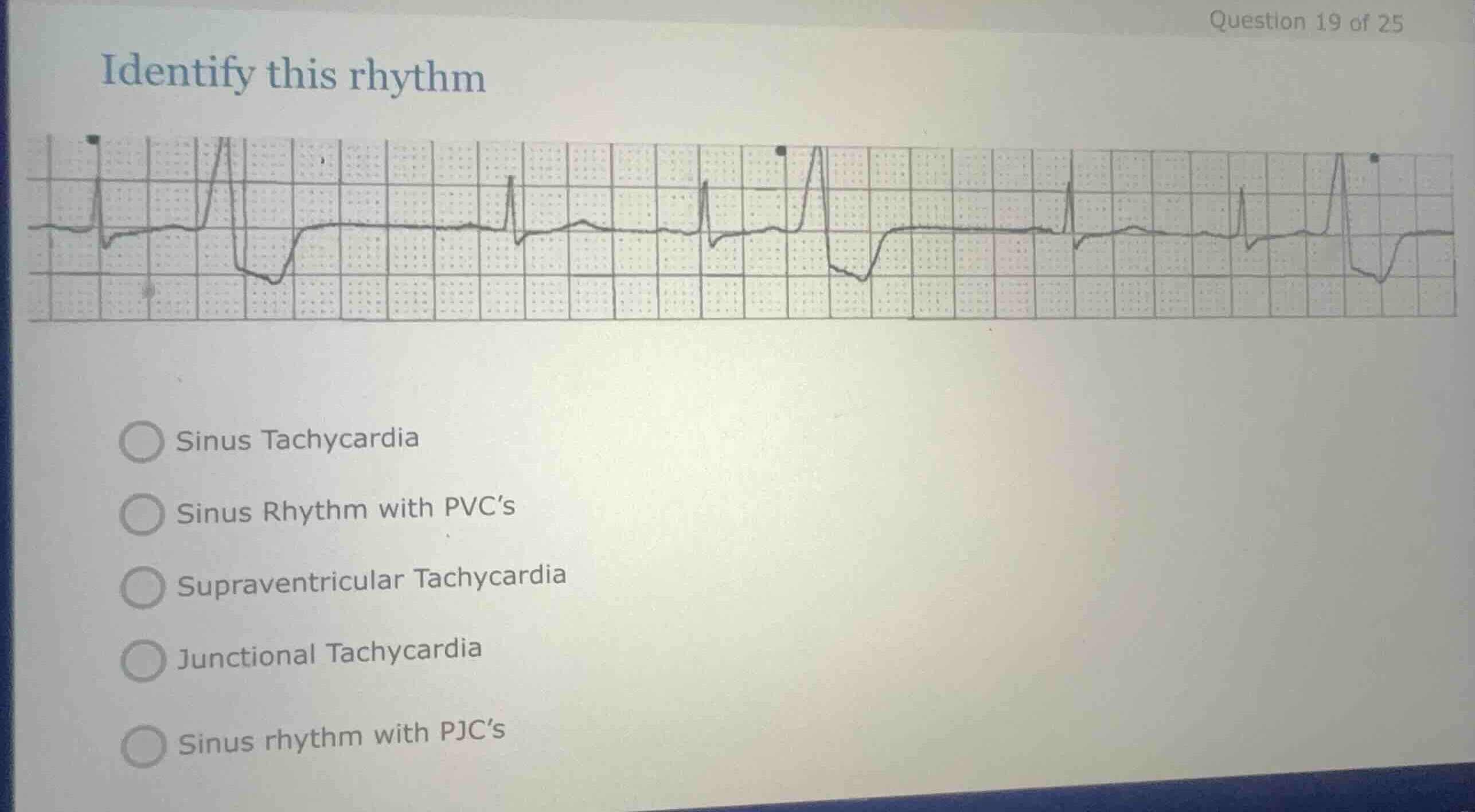 identify this rhythm sinus tachycardia sinus rhythm with pvcs supravent…