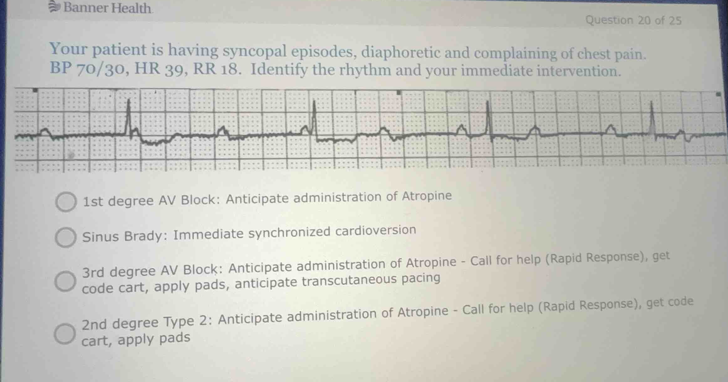 your patient is having syncopal episodes, diaphoretic and complaining o…