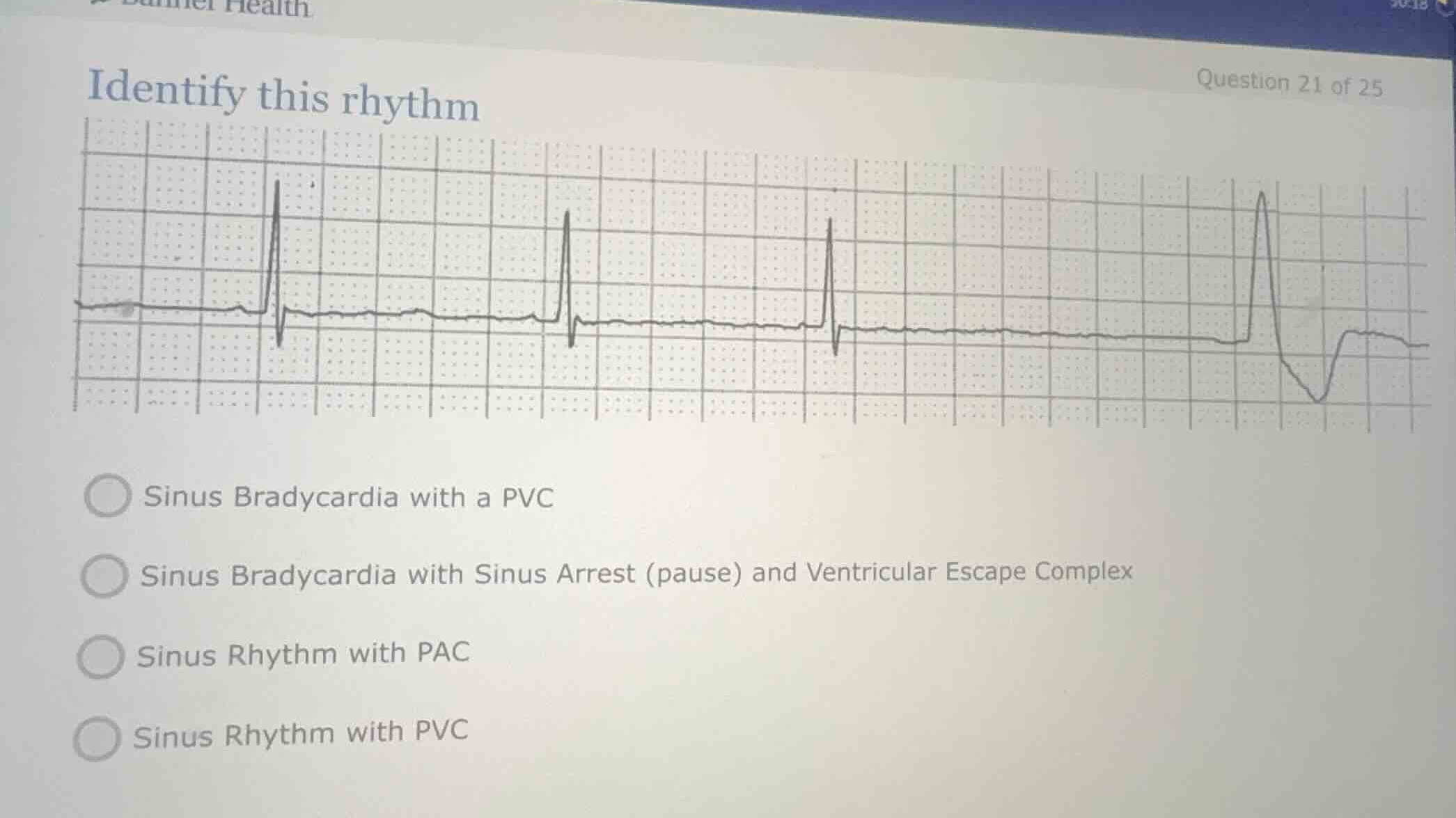 identify this rhythm sinus bradycardia with a pvc sinus bradycardia wit…
