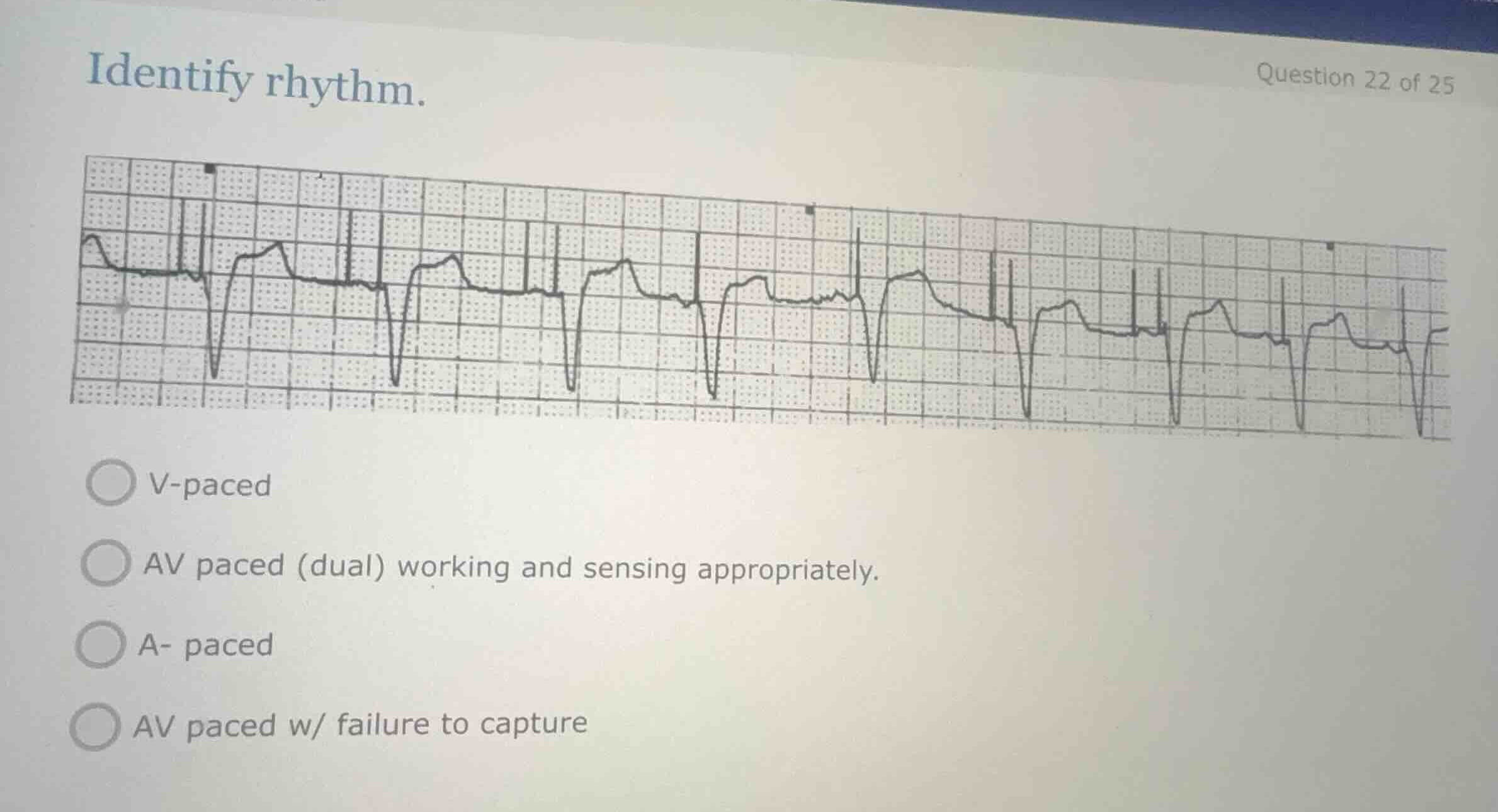 identify rhythm. v-paced av paced (dual) working and sensing appropriat…