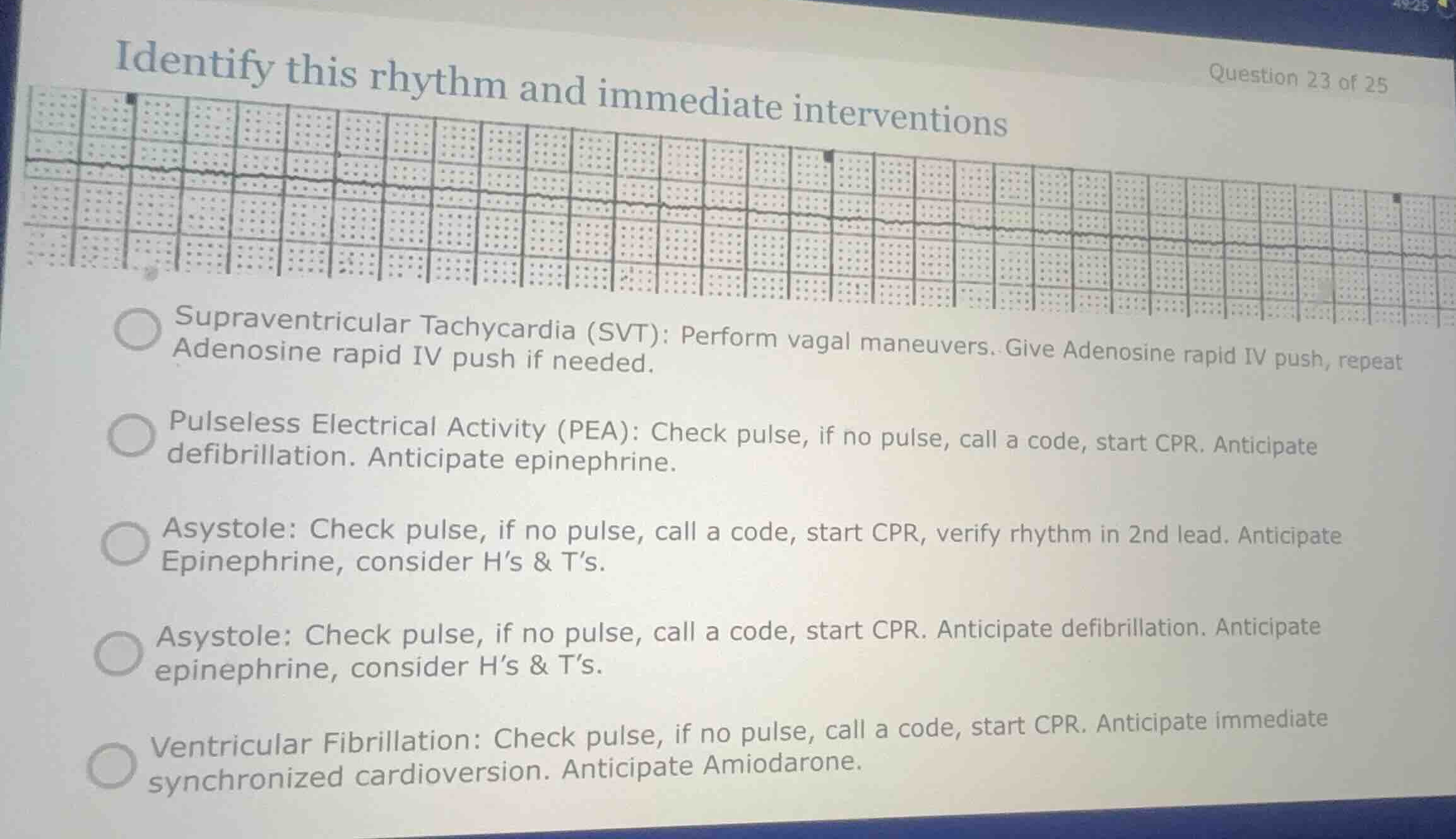 identify this rhythm and immediate interventions supraventricular tachy…