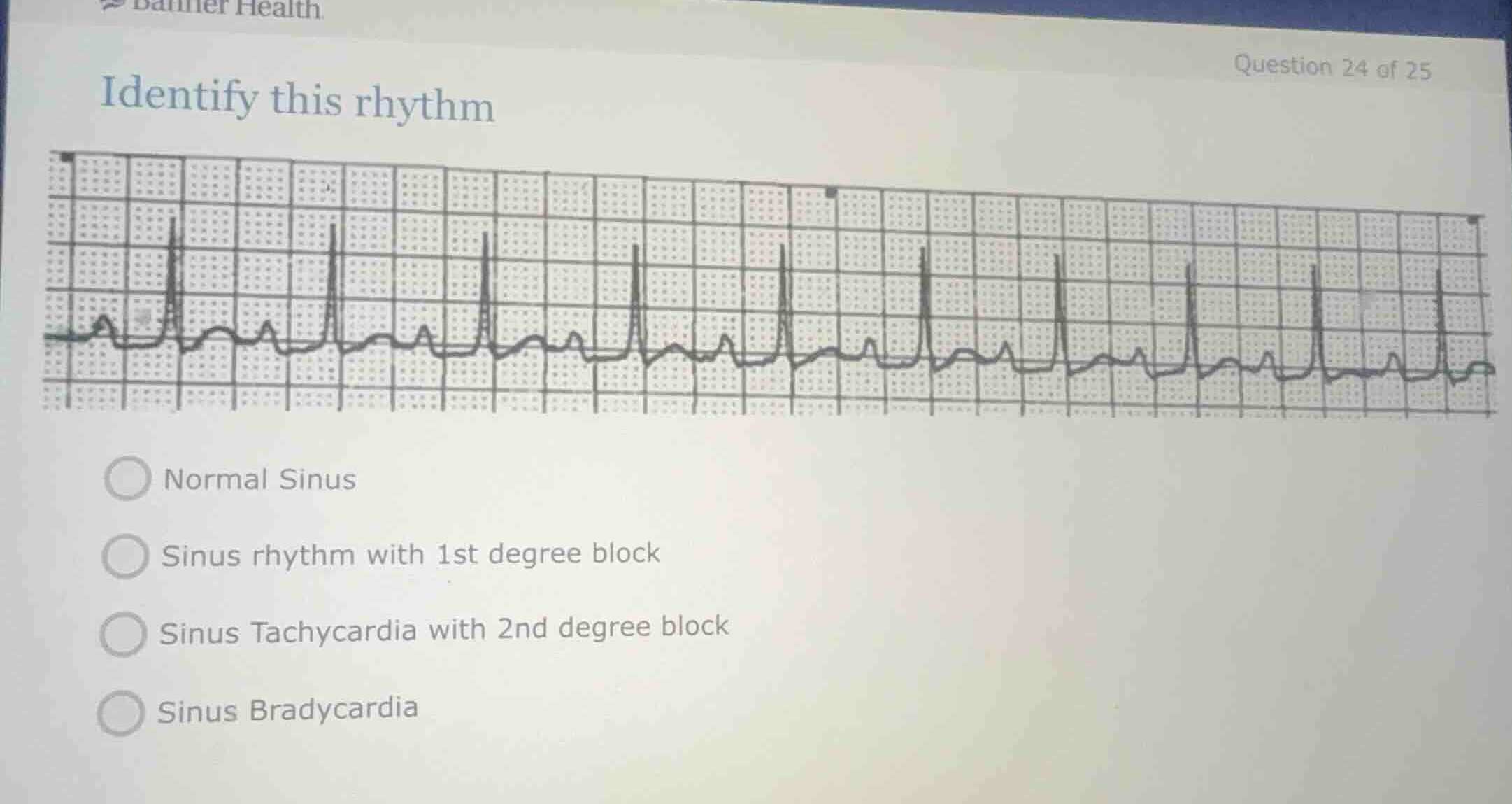 identify this rhythm normal sinus sinus rhythm with 1st degree block si…