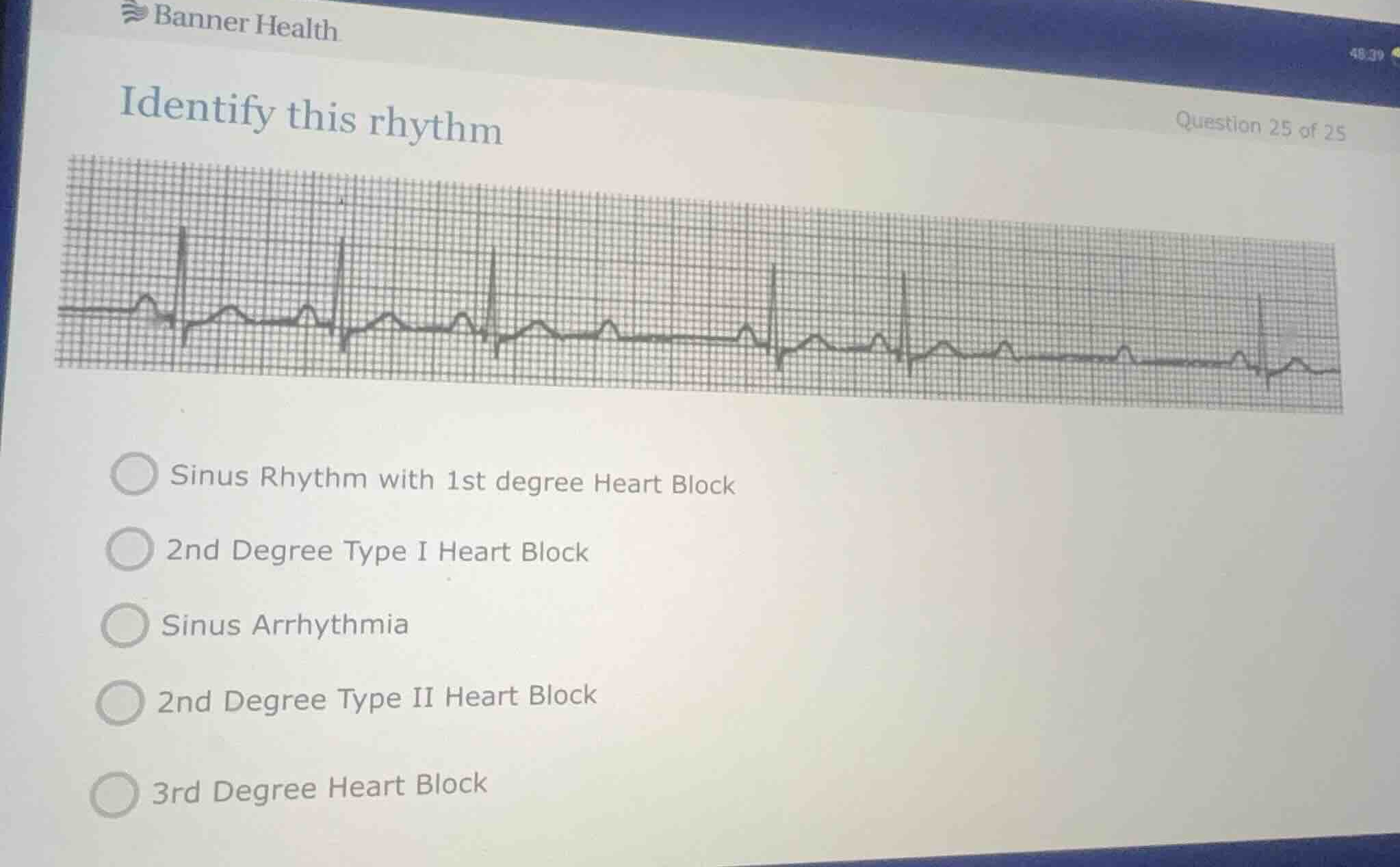 identify this rhythm sinus rhythm with 1st degree heart block 2nd degre…