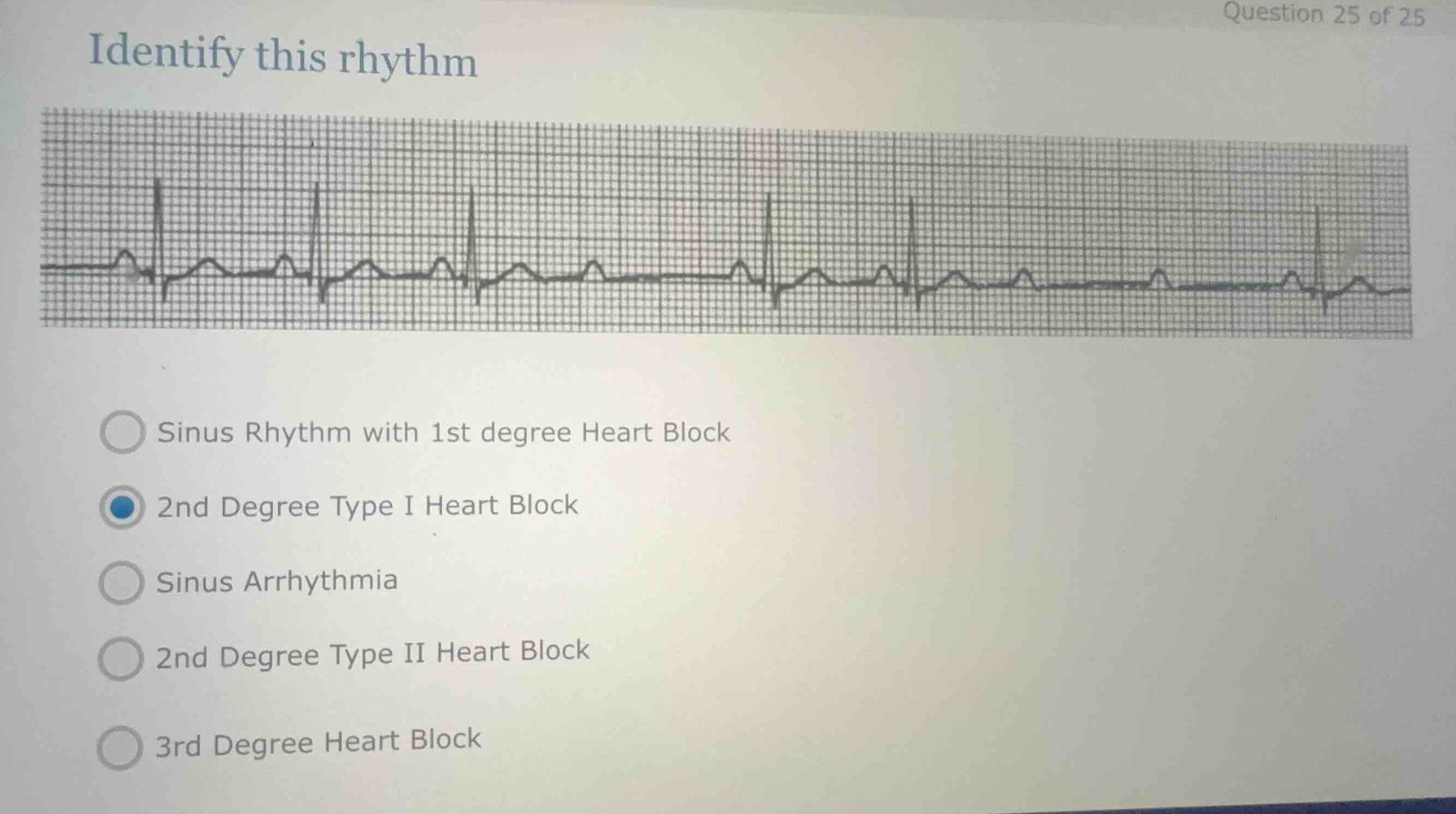 identify this rhythm sinus rhythm with 1st degree heart block 2nd degre…