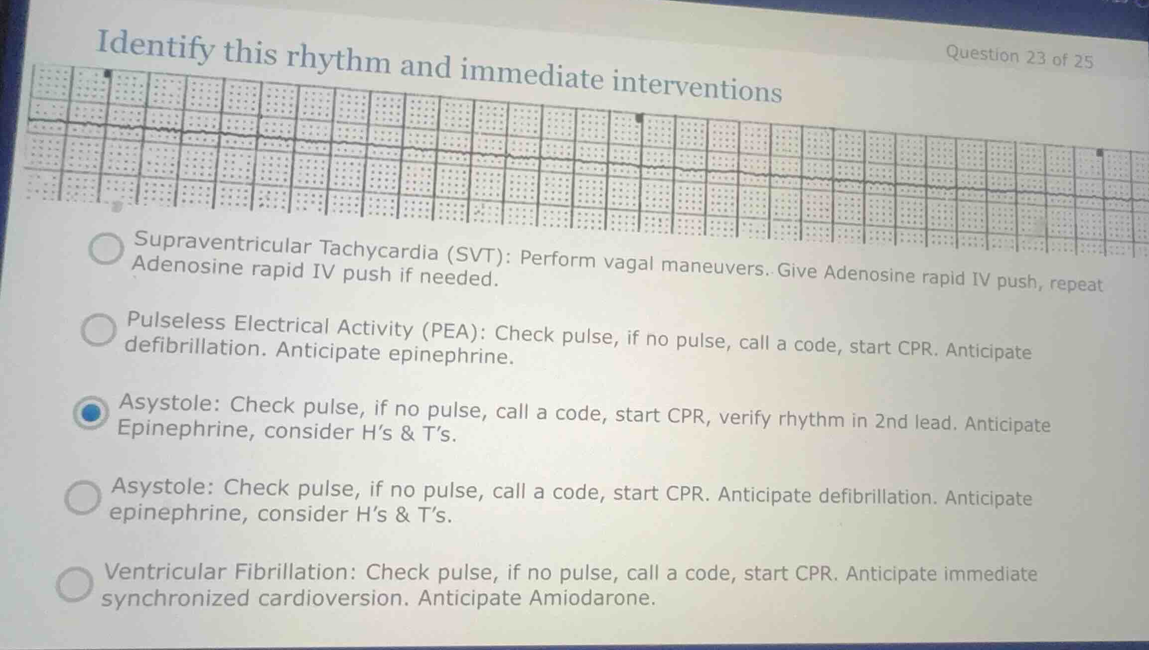 identify this rhythm and immediate interventions supraventricular tachy…