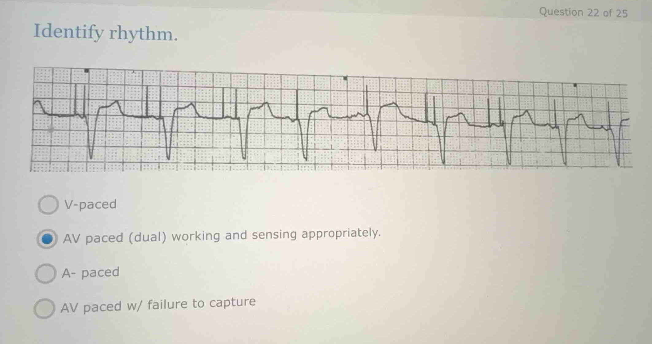 identify rhythm. v-paced av paced (dual) working and sensing appropriat…