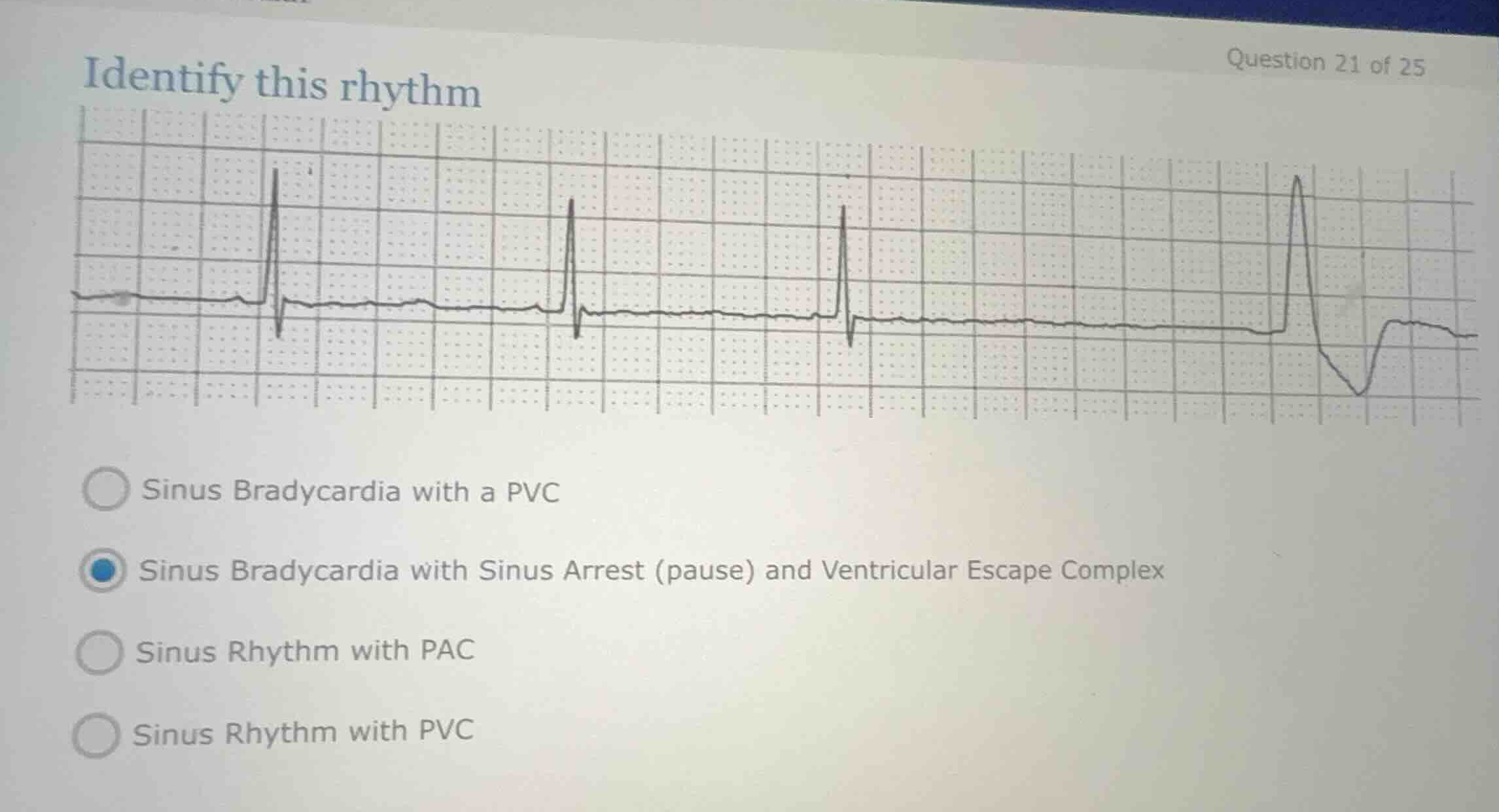 identify this rhythm sinus bradycardia with a pvc sinus bradycardia wit…