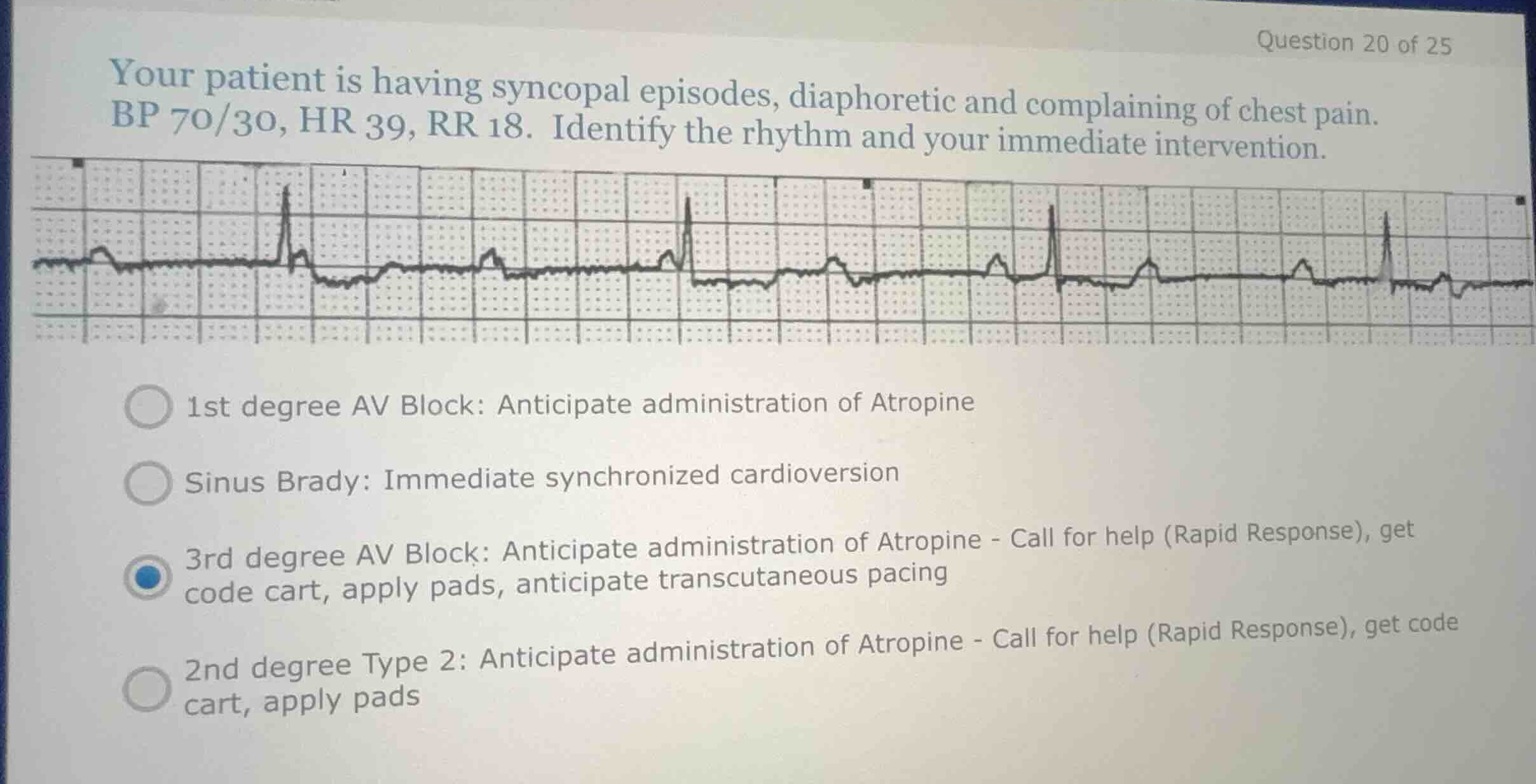 your patient is having syncopal episodes, diaphoretic and complaining o…