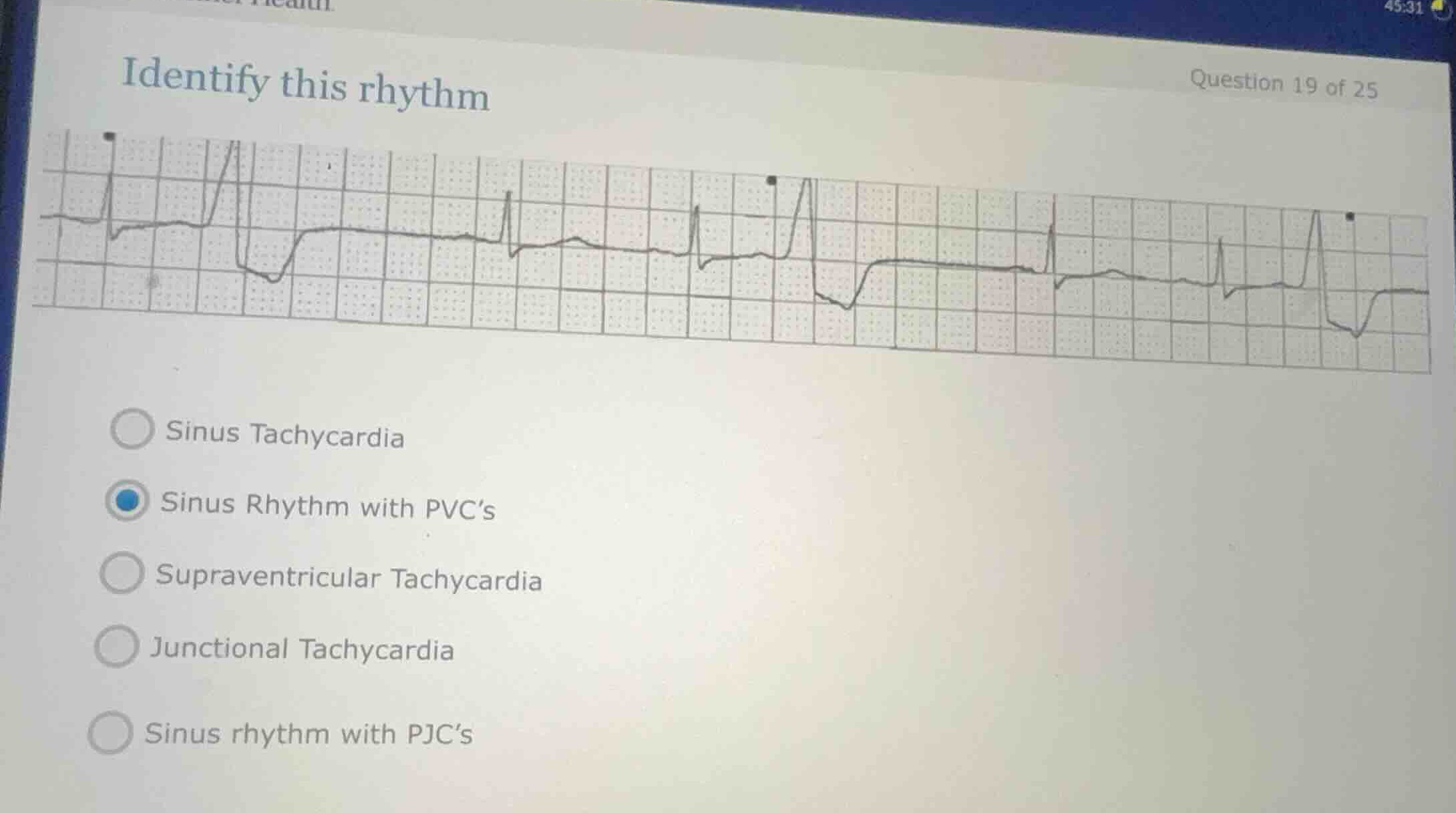 identify this rhythm * sinus tachycardia * sinus rhythm with pvcs * sup…