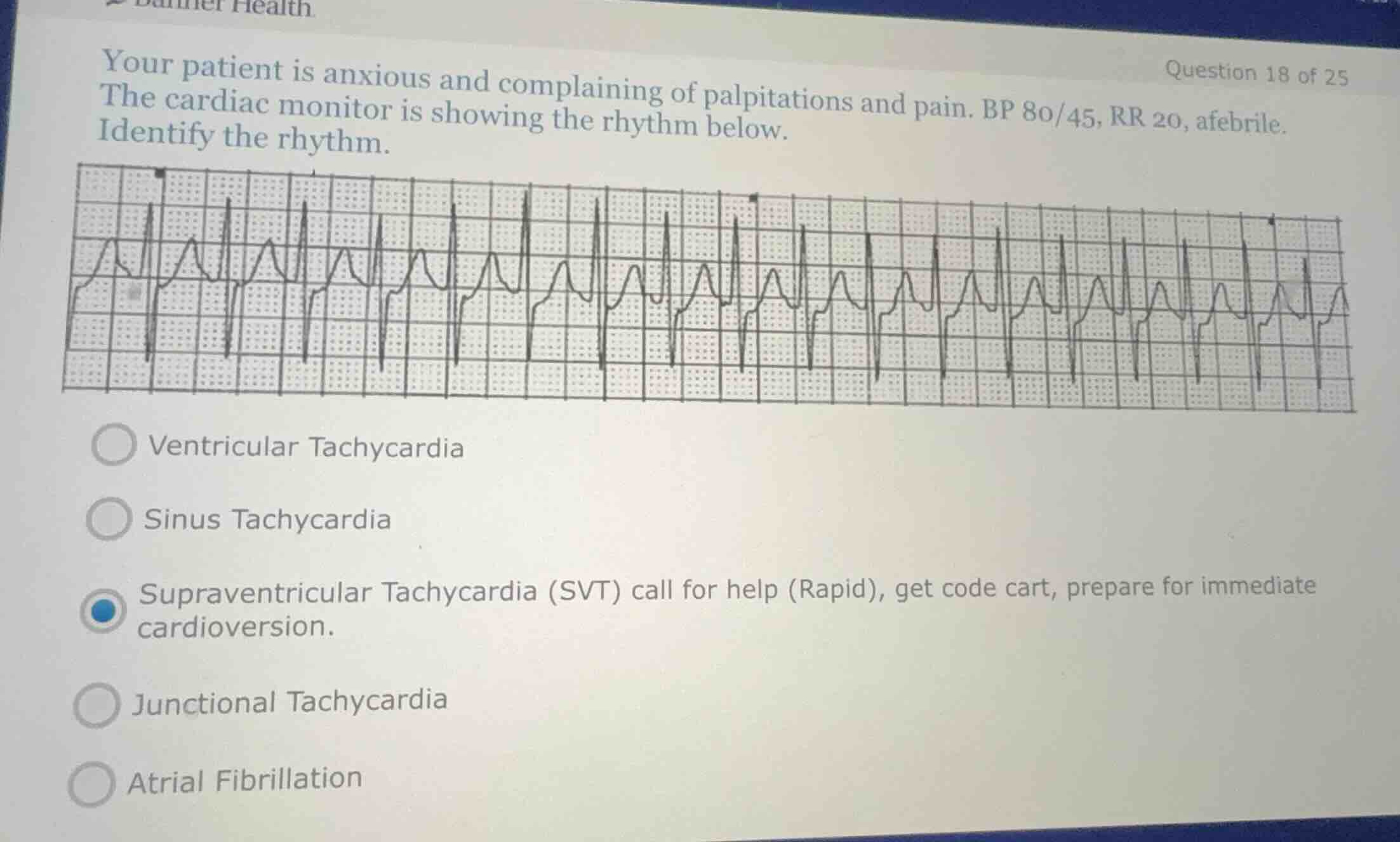 your patient is anxious and complaining of palpitations and pain. bp 80…