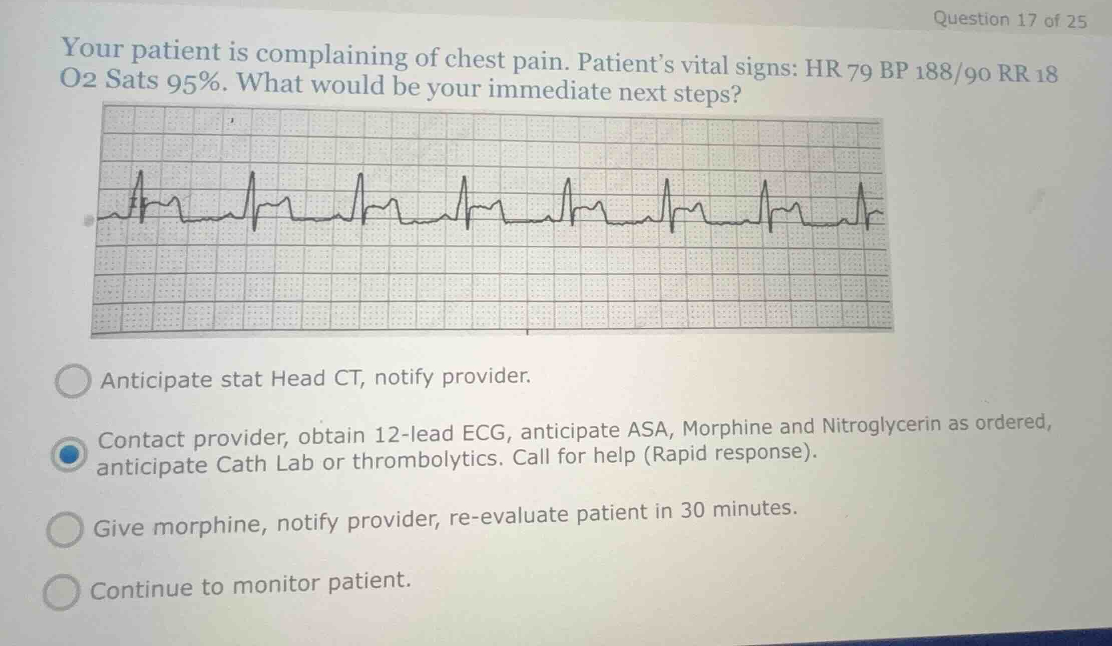 question 17 of 25 your patient is complaining of chest pain. patients v…
