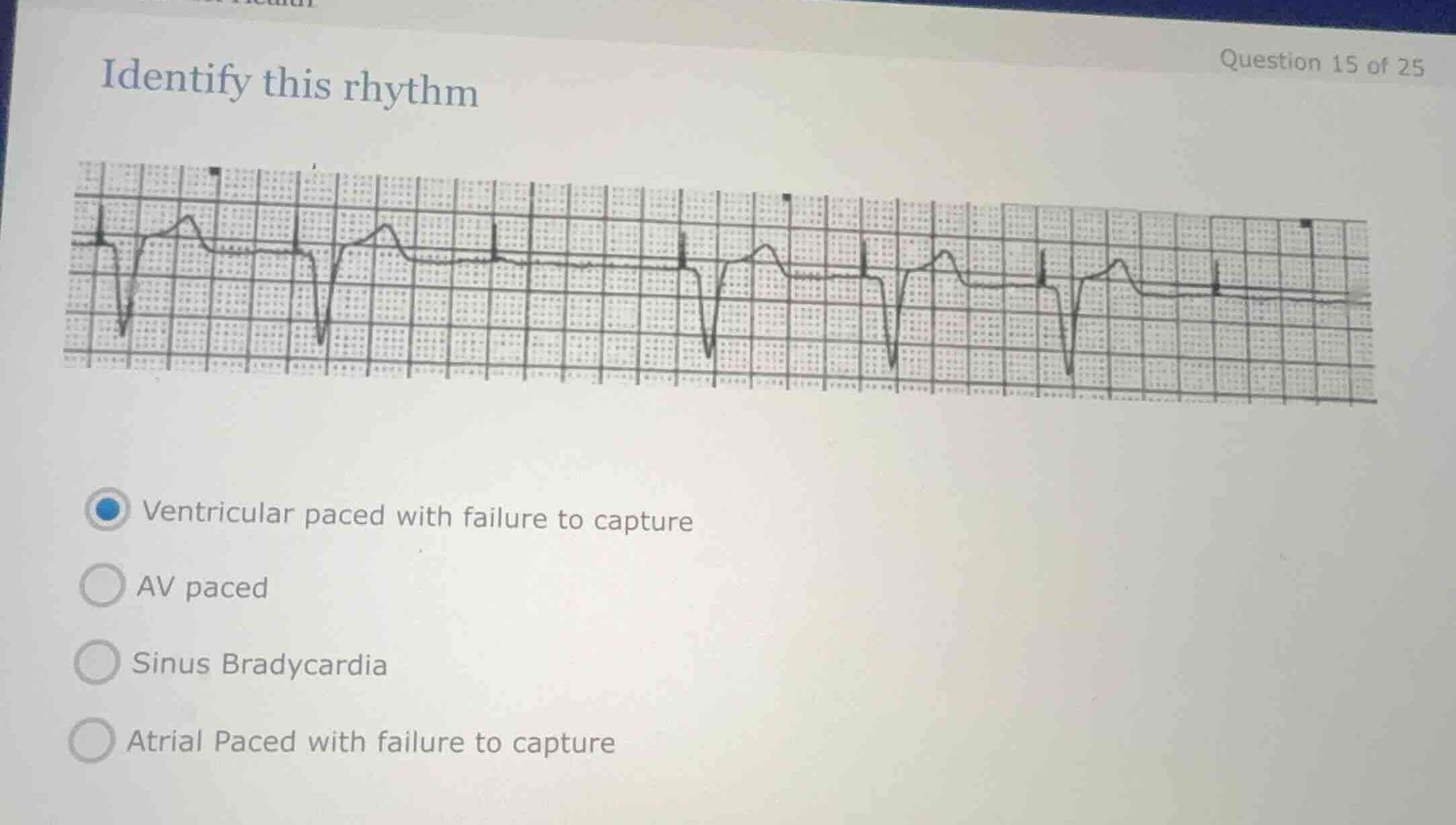 identify this rhythm ventricular paced with failure to capture av paced…