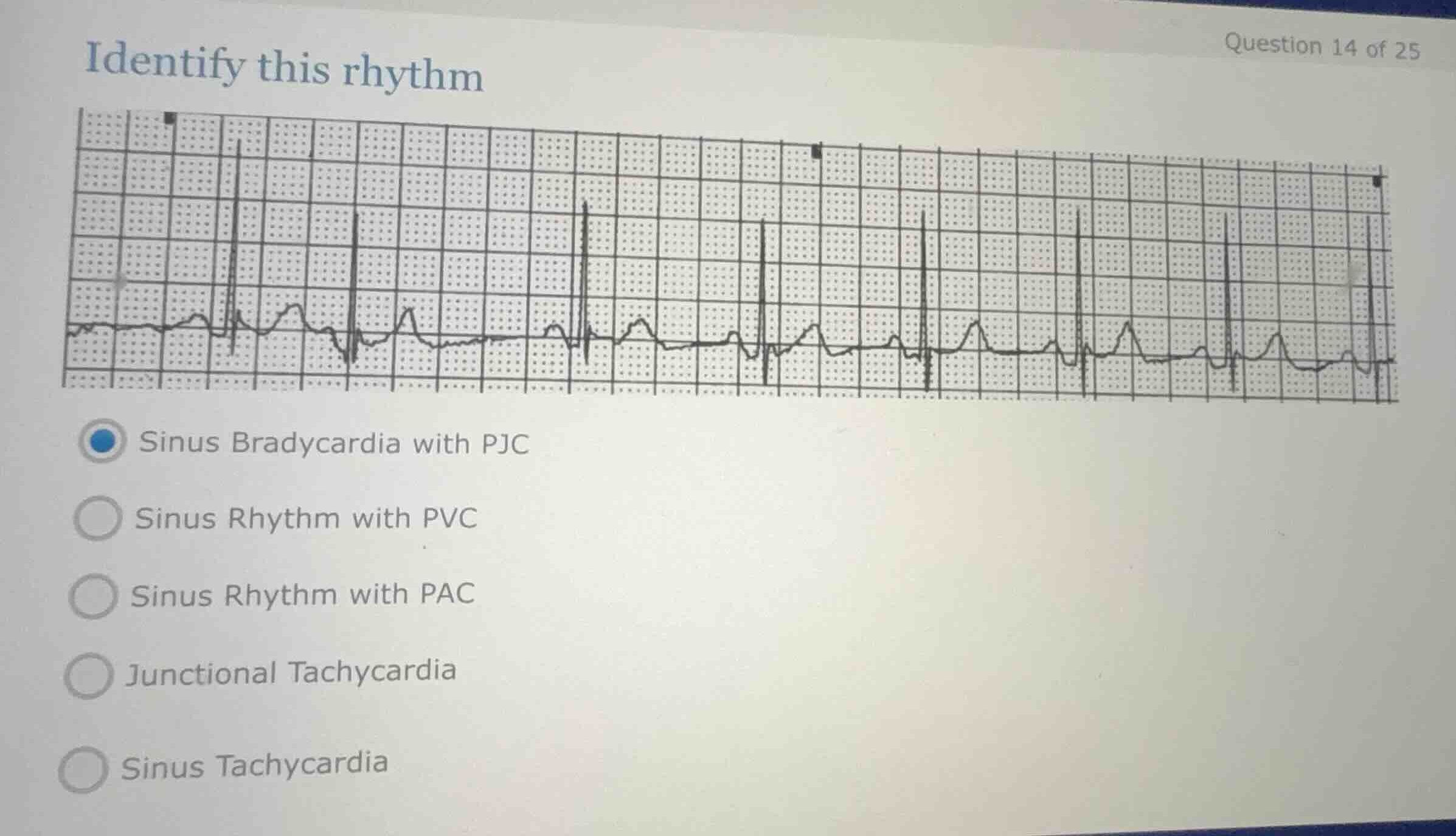 identify this rhythm sinus bradycardia with pjc sinus rhythm with pvc s…