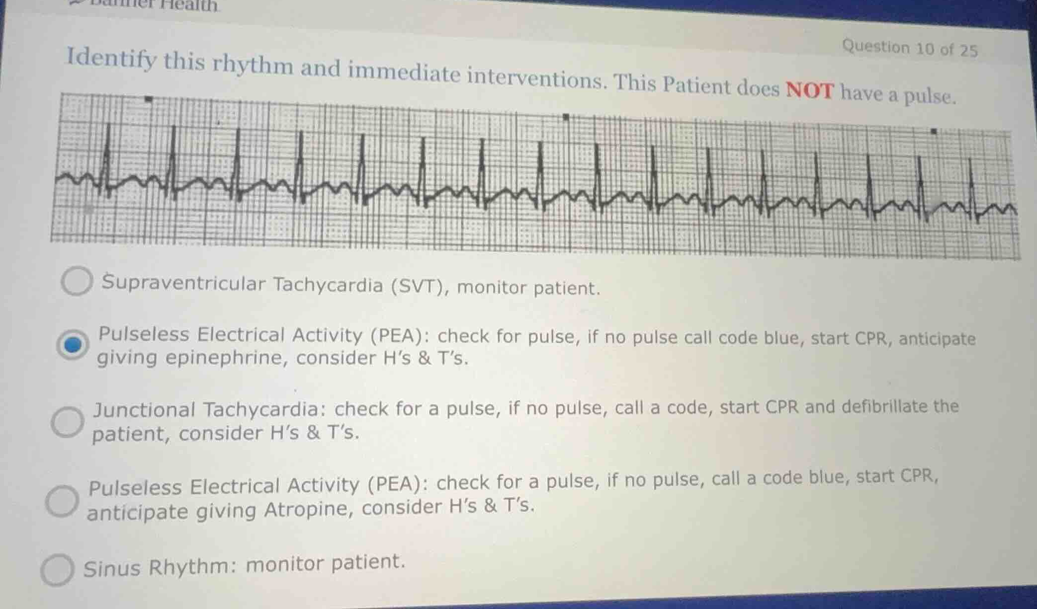 identify this rhythm and immediate interventions. this patient does not…