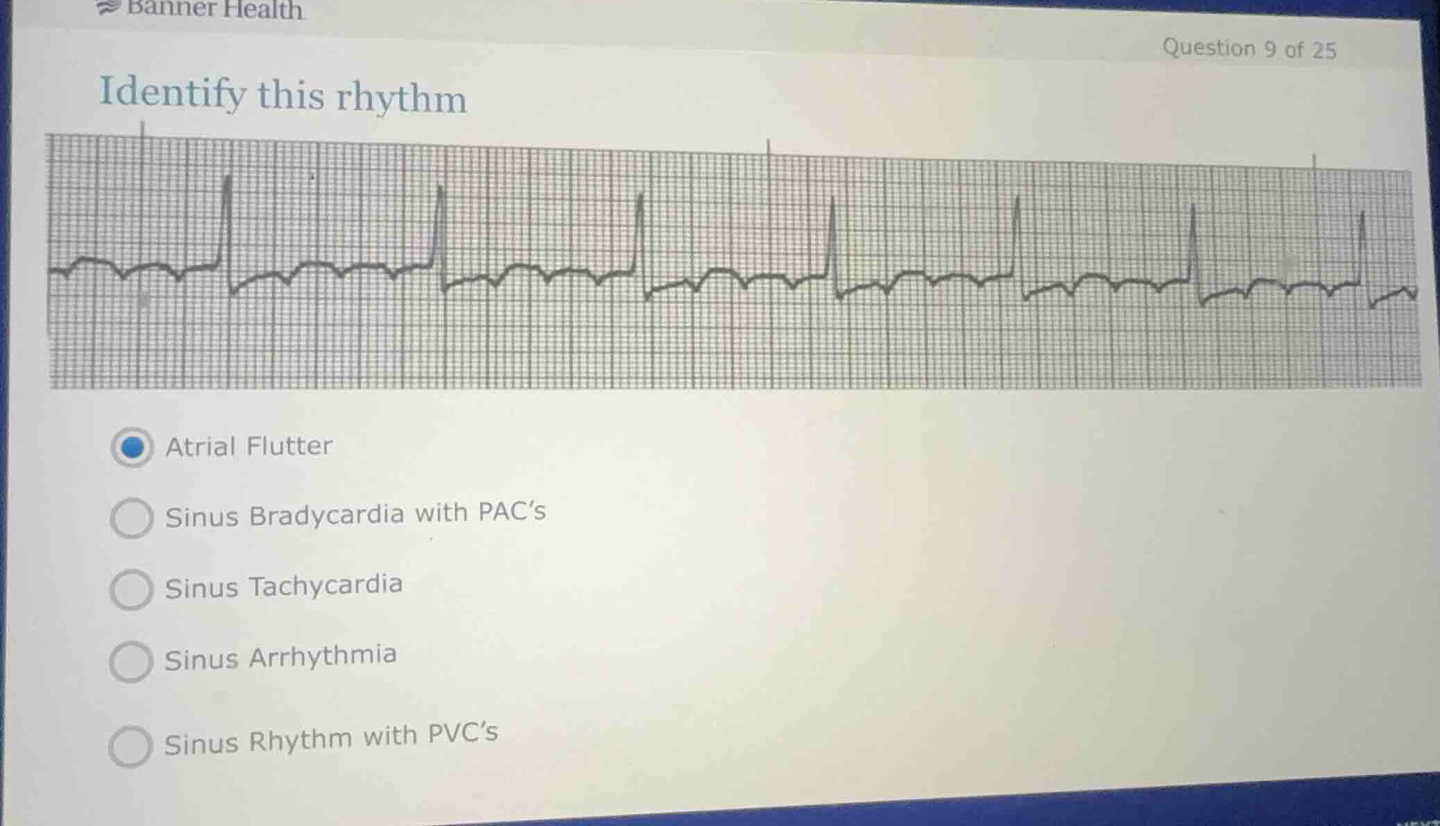 identify this rhythm atrial flutter sinus bradycardia with pacs sinus t…