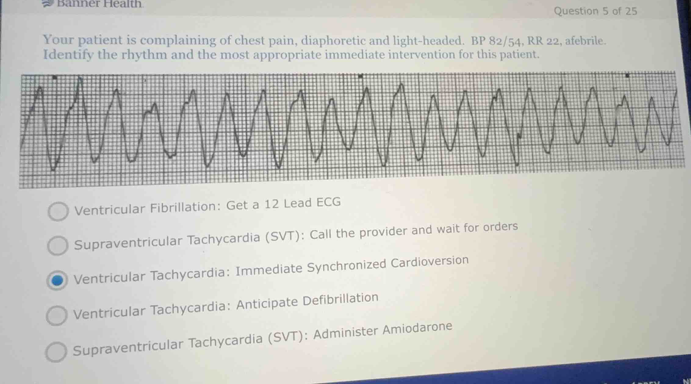 your patient is complaining of chest pain, diaphoretic and light-headed…
