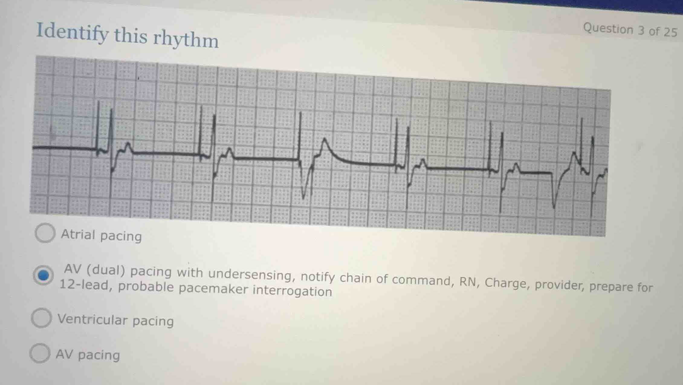 identify this rhythm question 3 of 25 atrial pacing av (dual) pacing wi…