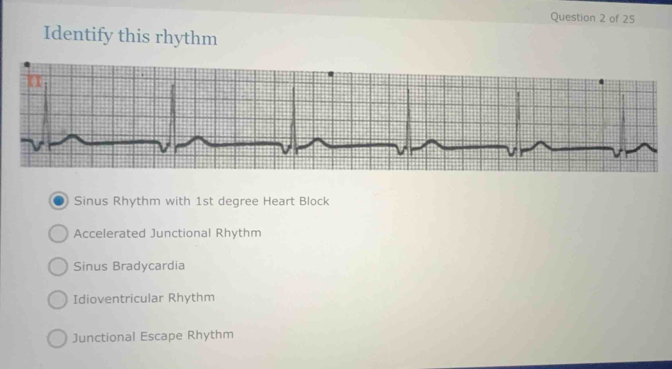 question 2 of 25 identify this rhythm sinus rhythm with 1st degree hear…