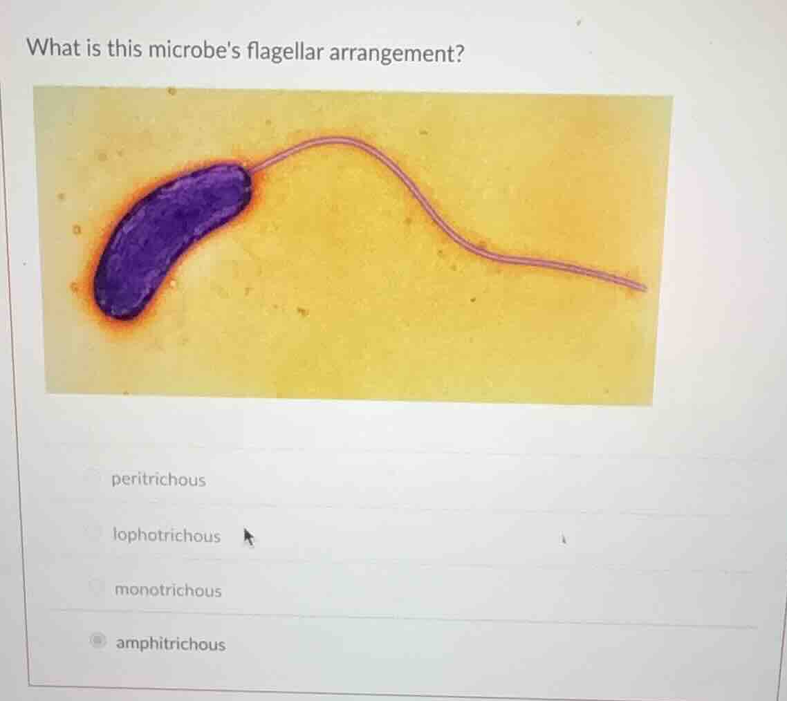 what is this microbes flagellar arrangement? peritrichous lophotrichous…