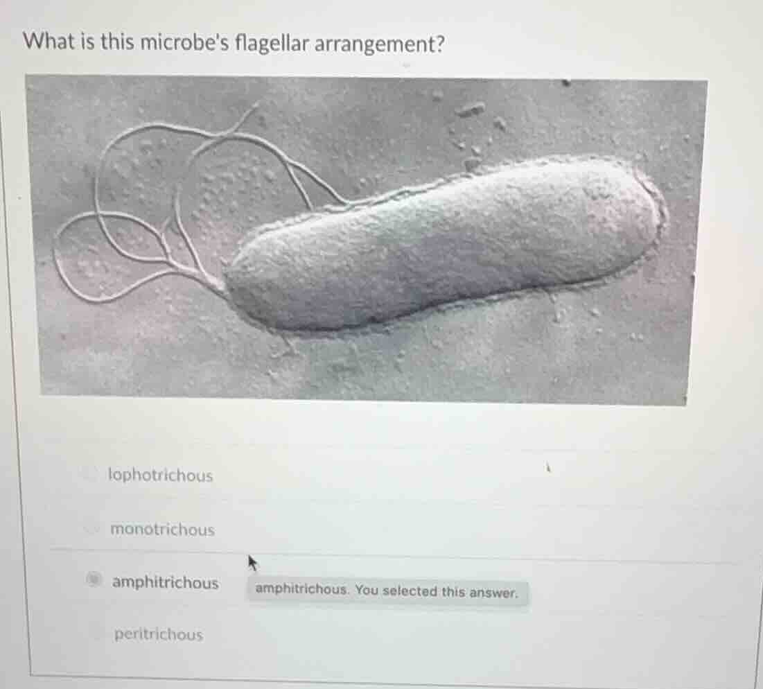what is this microbes flagellar arrangement? lophotrichous monotrichous…