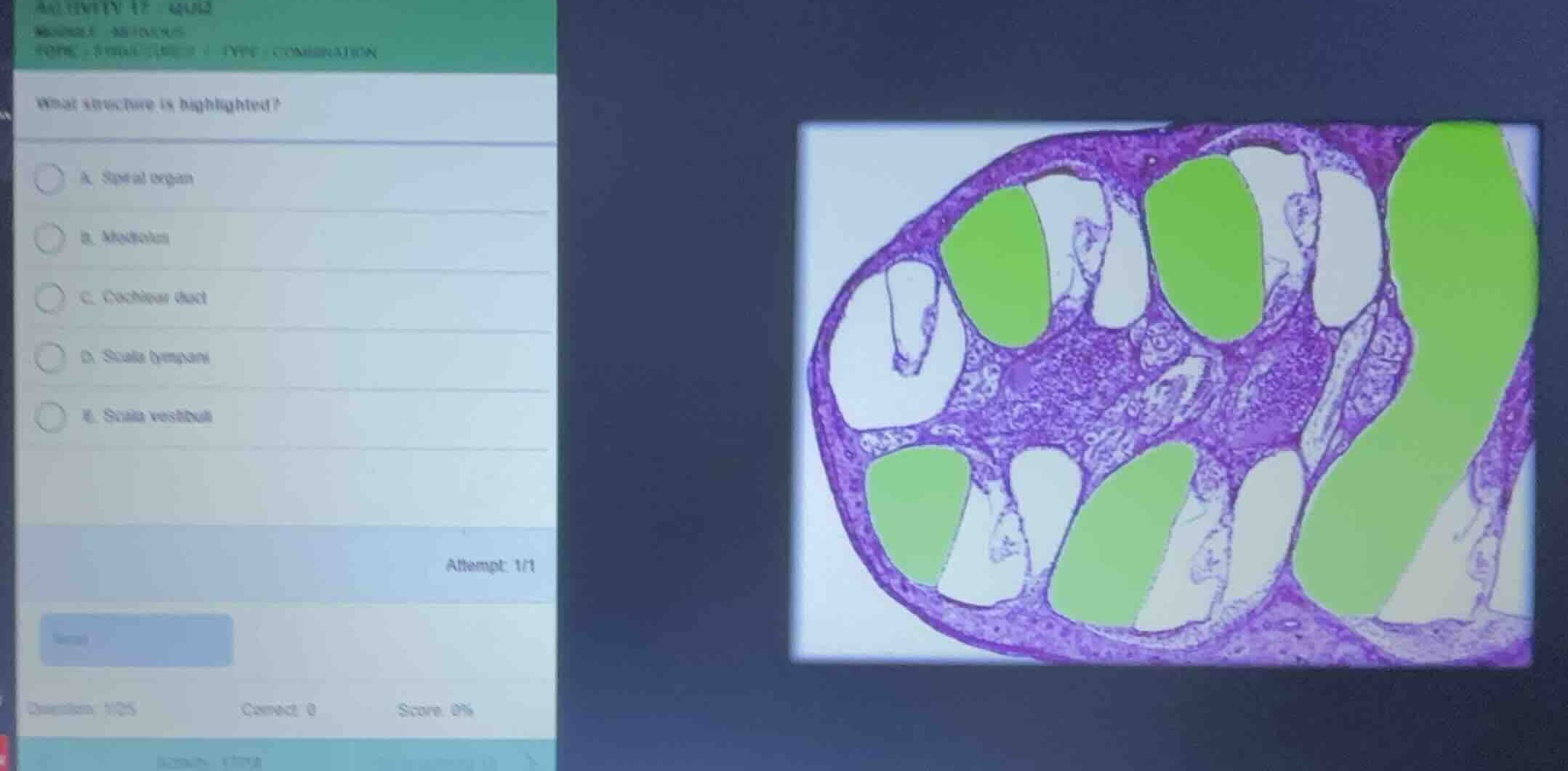 what structure is highlighted? a. spiral organ b. modiolus c. cochlear …