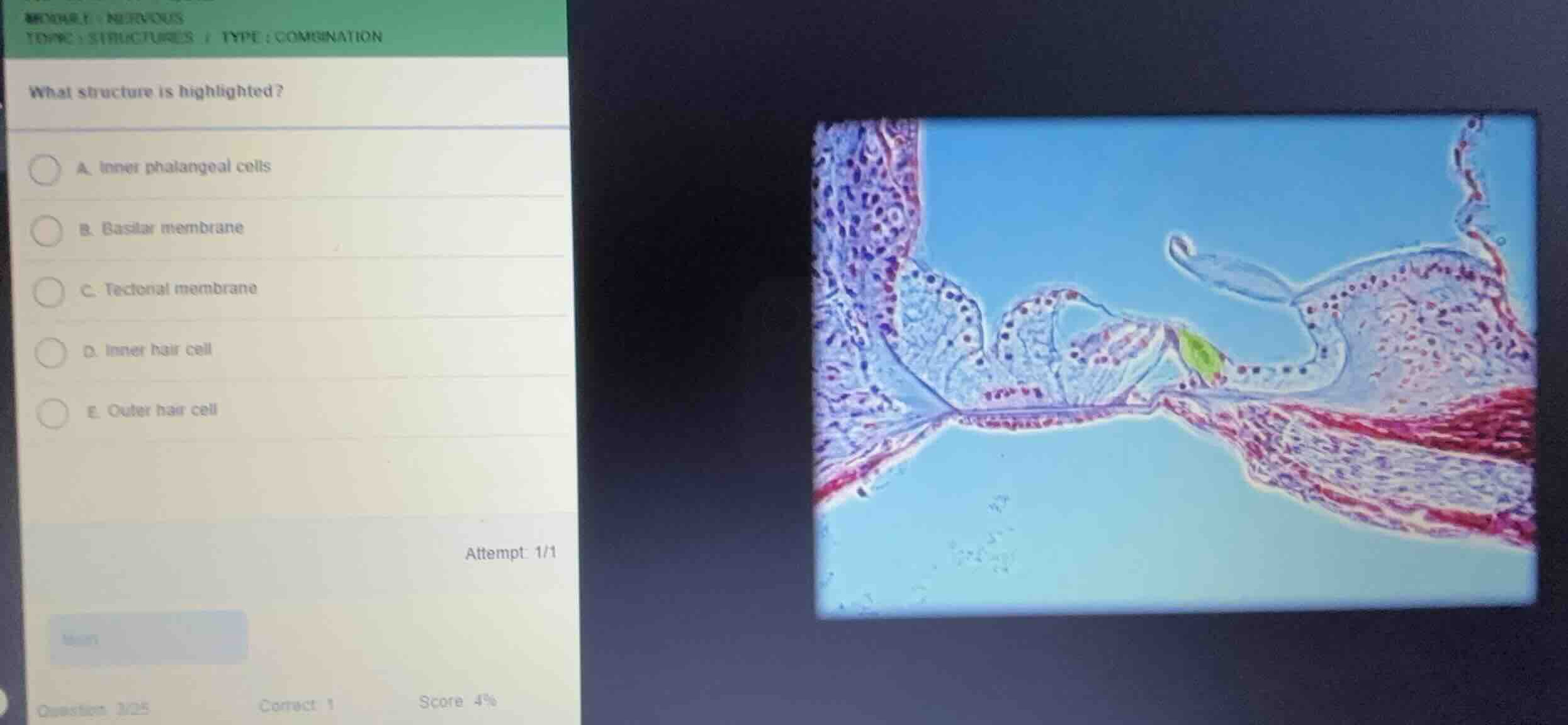 what structure is highlighted? a. inner phalangeal cells b. basilar mem…