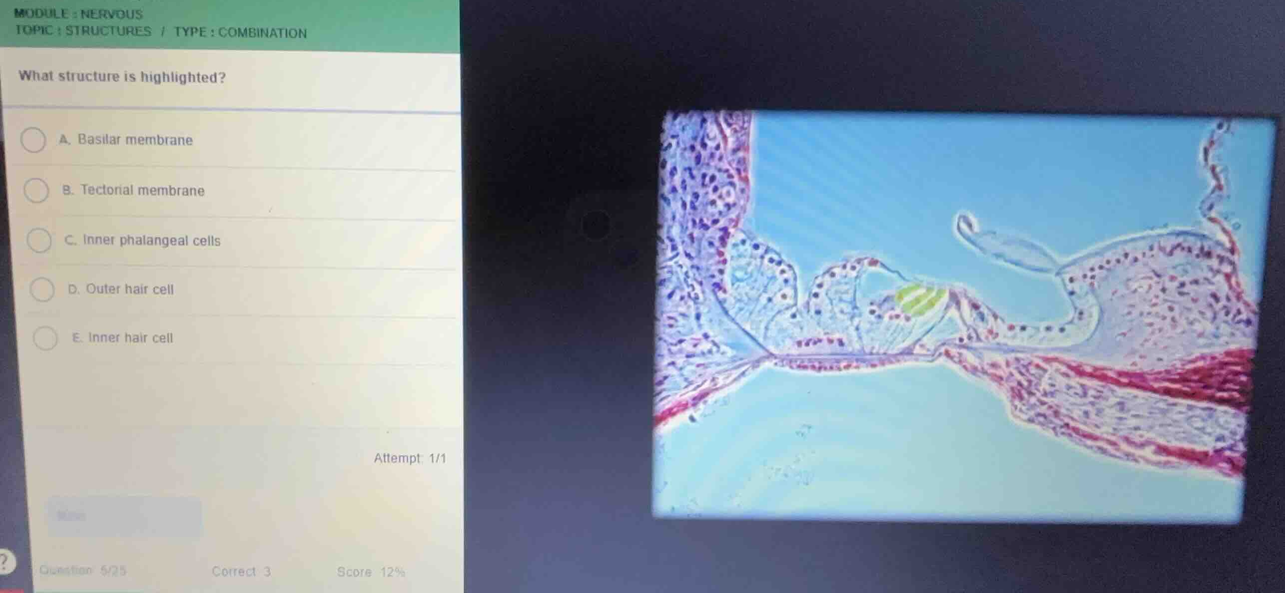 module: nervous topic: structures / type: combination what structure is…