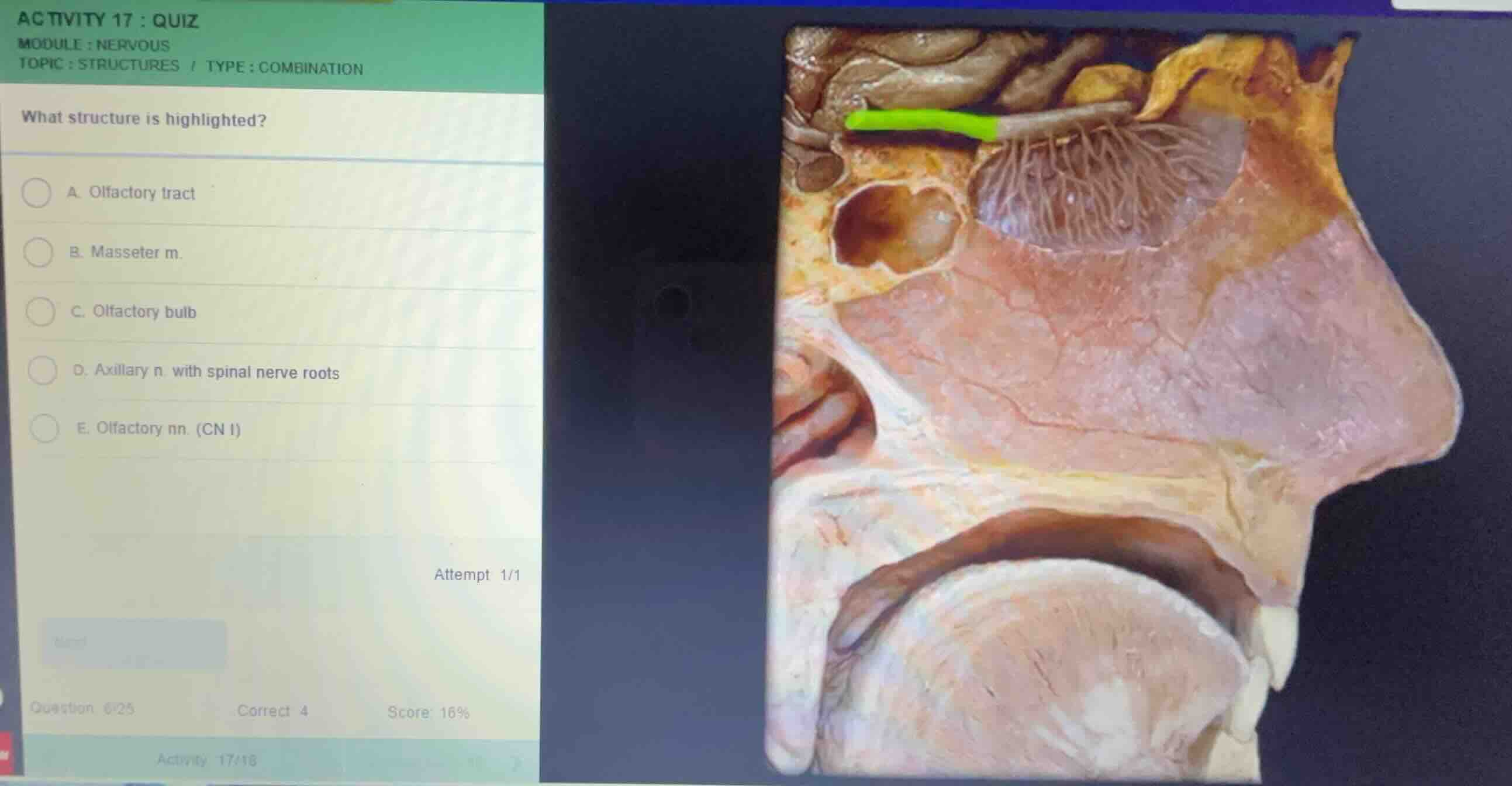 activity 17 : quiz module : nervous topic : structures / type : combina…