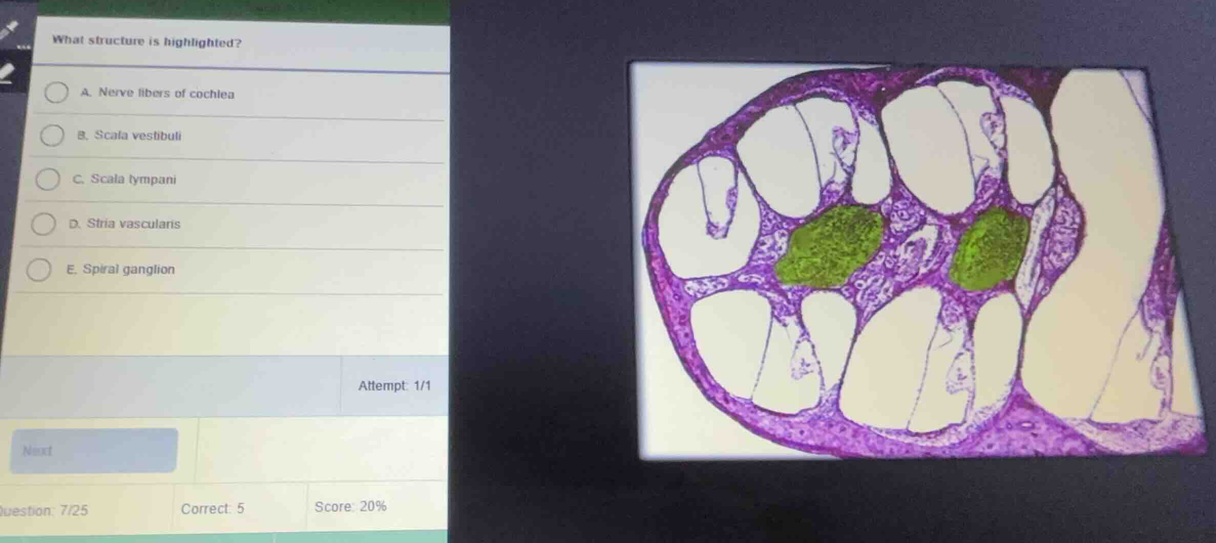 what structure is highlighted? a. nerve fibers of cochlea b. scala vest…
