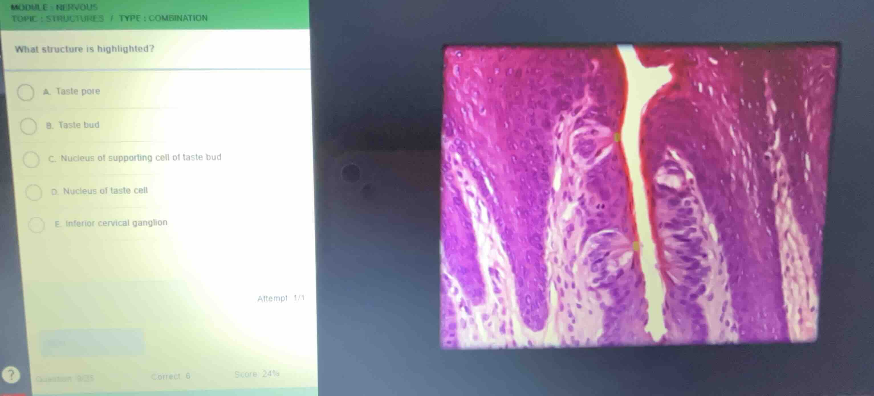 module: nervous topic: structures / type: combination what structure is…