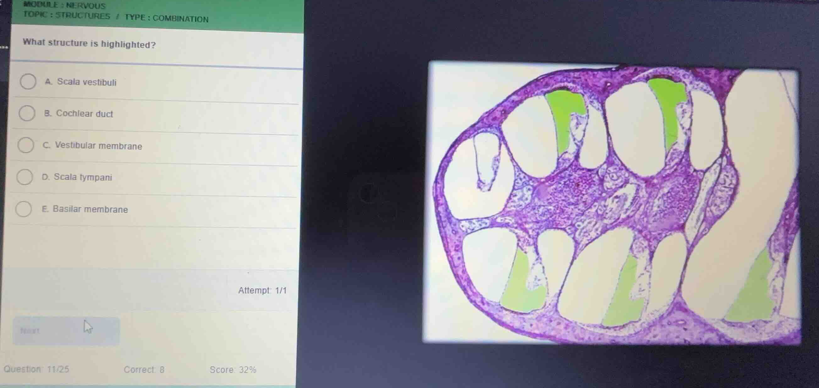 module: nervous topic: structures / type: combination what structure is…