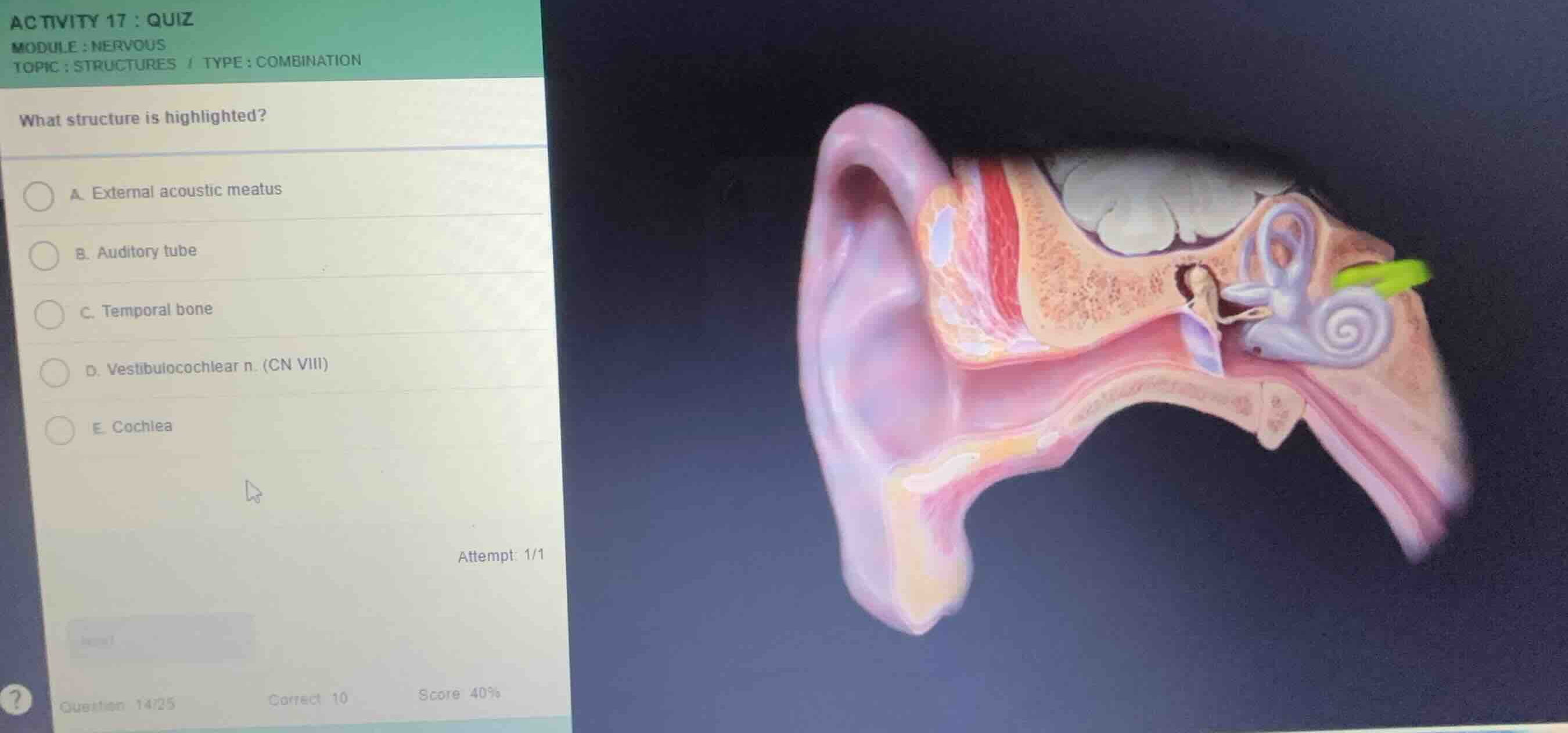 what structure is highlighted? a. external acoustic meatus b. auditory …