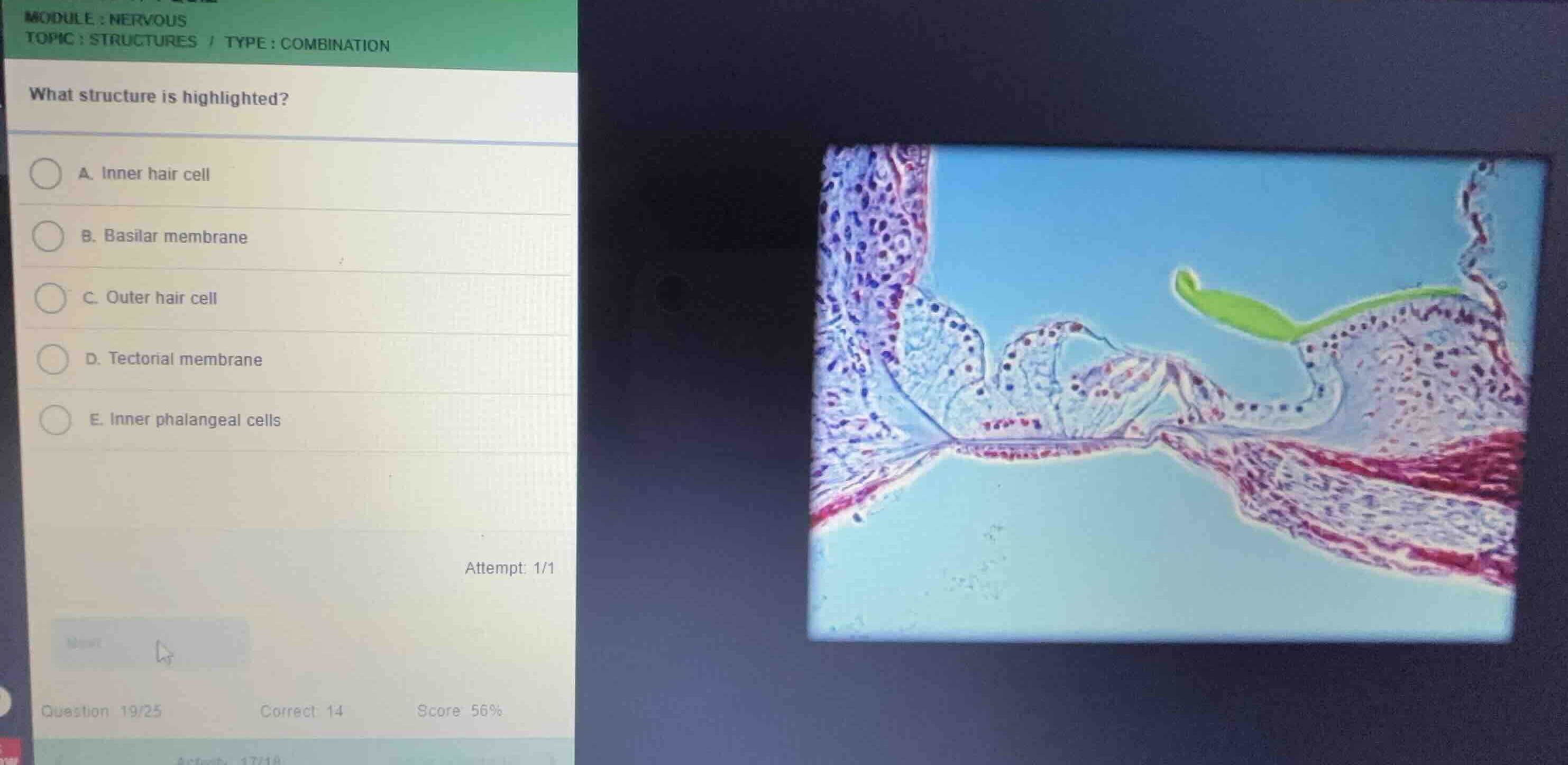 module: nervous topic: structures / type: combination what structure is…
