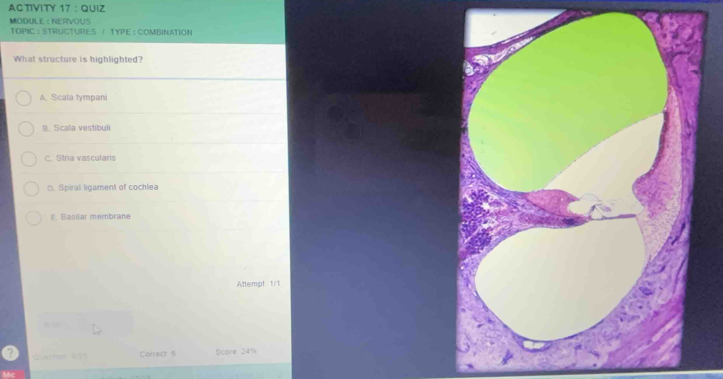 activity 17 : quiz module : nervous topic : structures / type : combina…