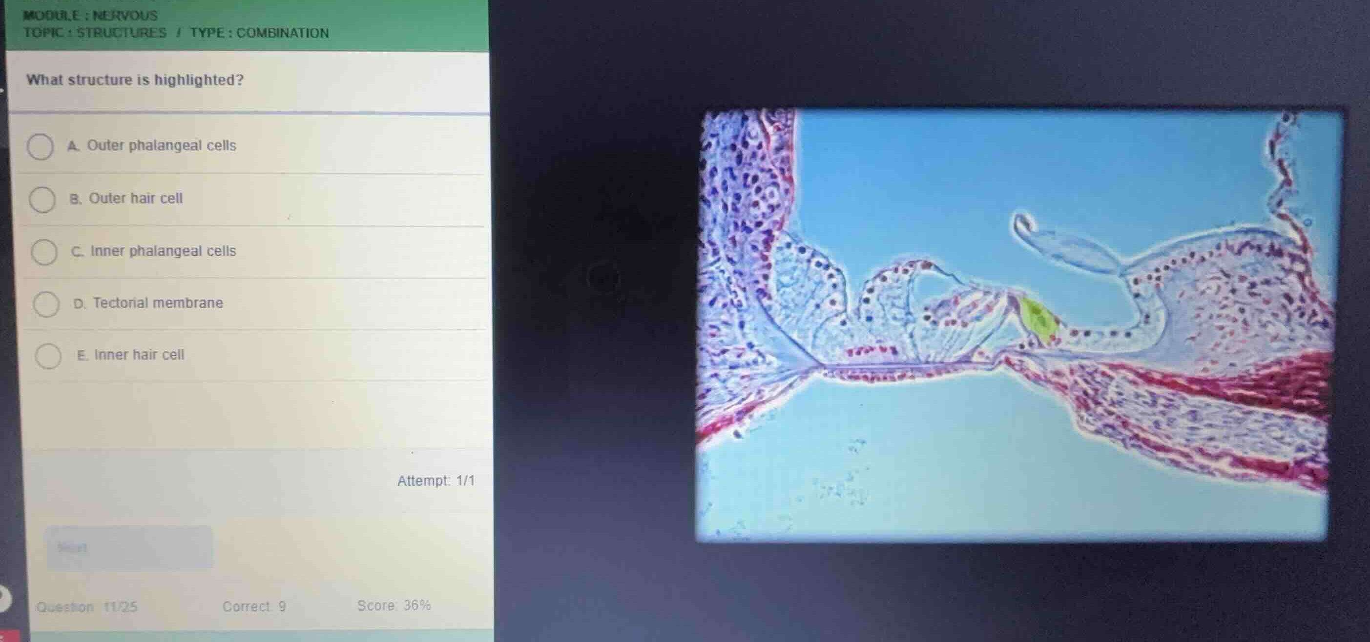 module: nervous topic: structures / type: combination what structure is…