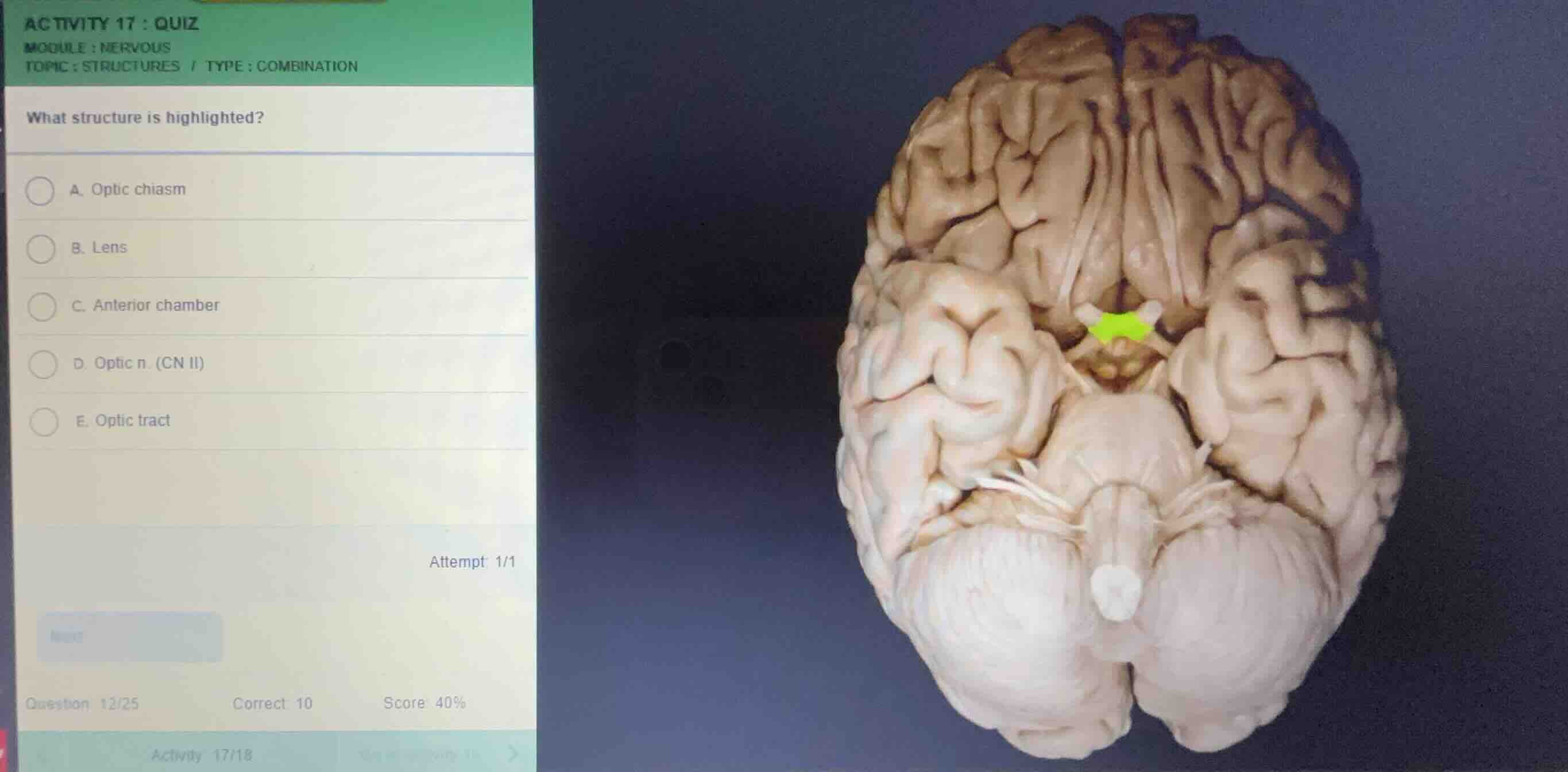 activity 17 : quiz module : nervous topic : structures / type : combina…