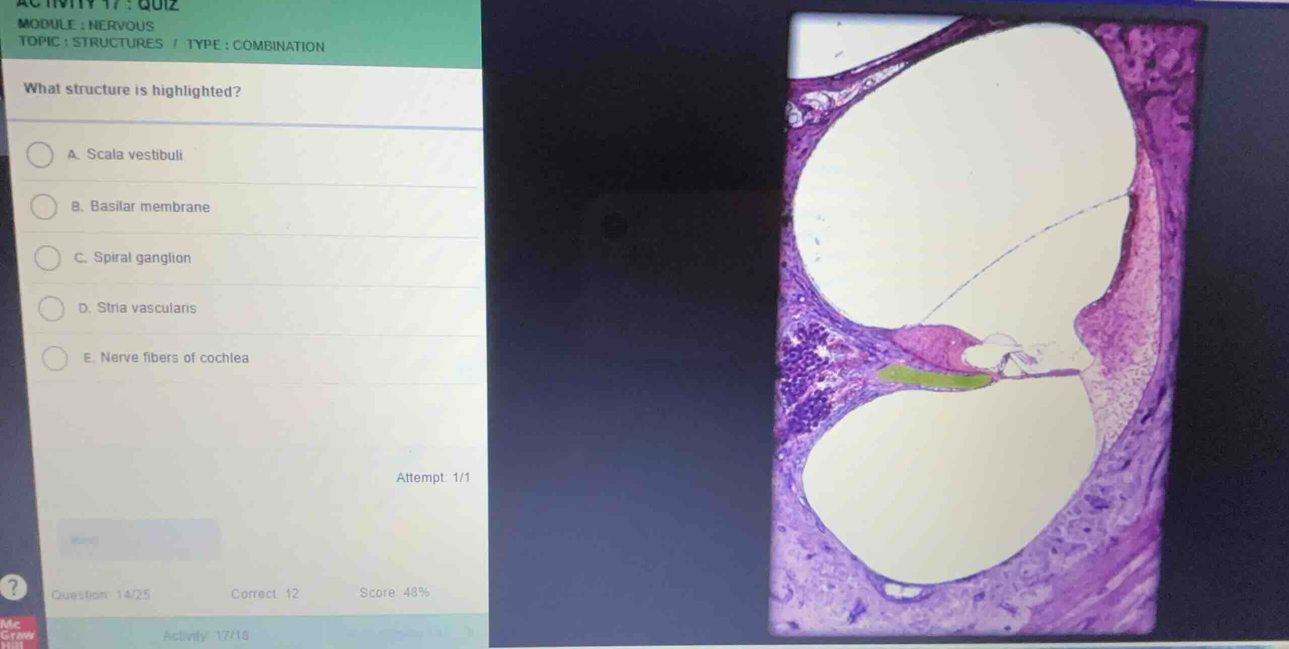 what structure is highlighted? a. scala vestibuli b. basilar membrane c…
