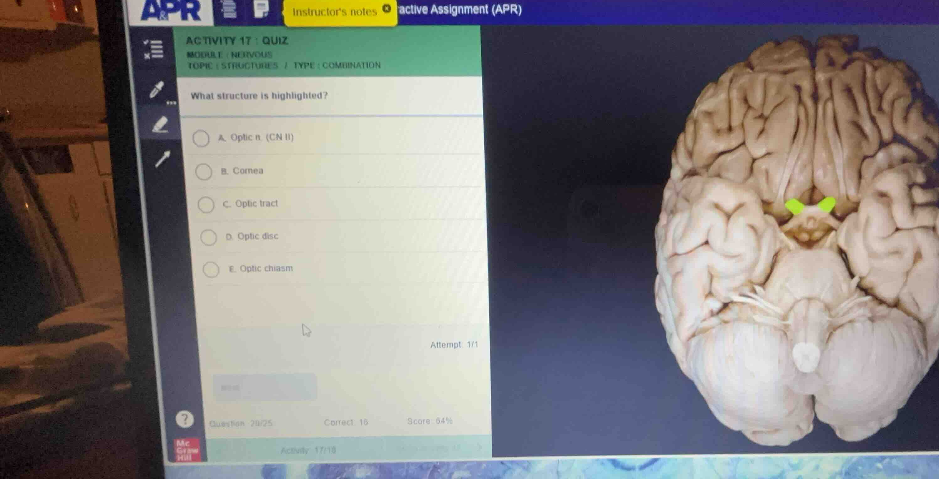 activity 17: quiz module: nervous topic: structures / type: combination…