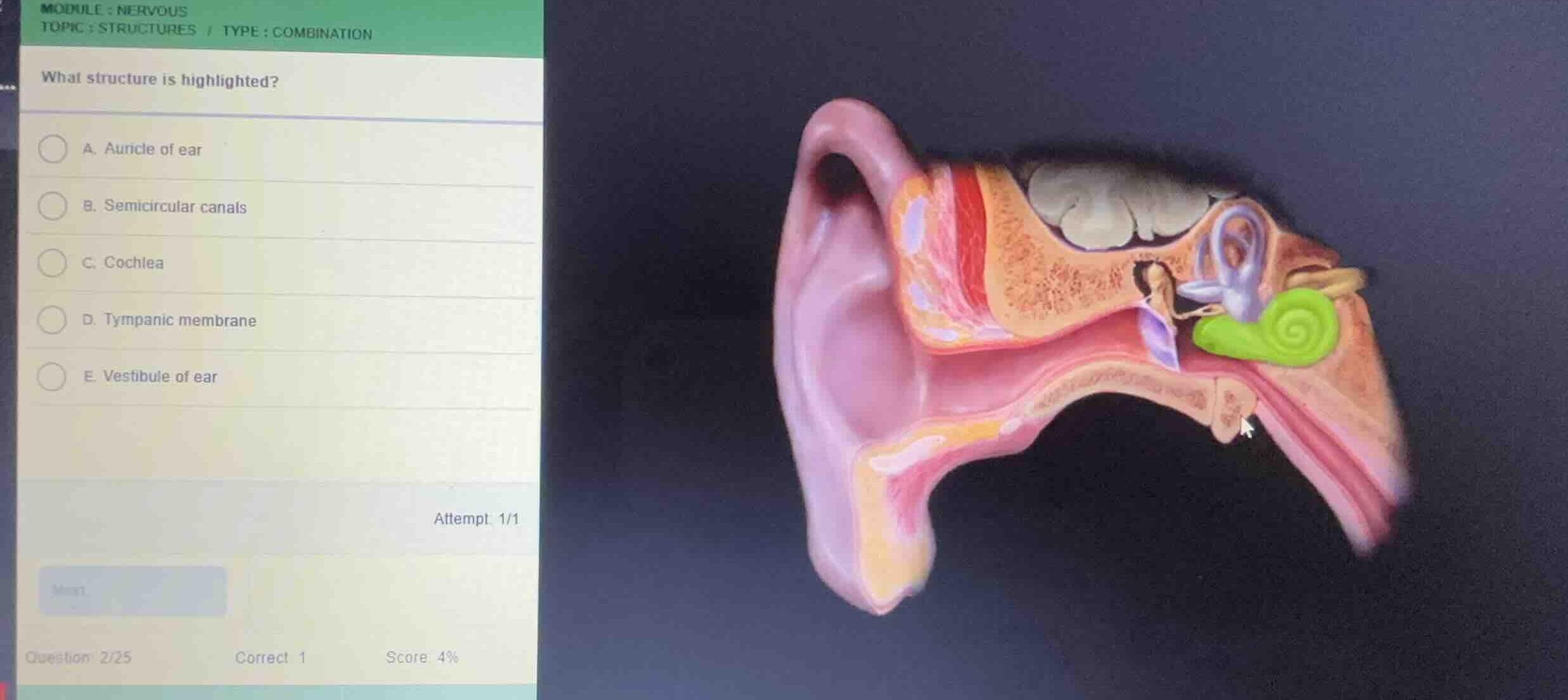 module: nervous topic: structures / type: combination what structure is…
